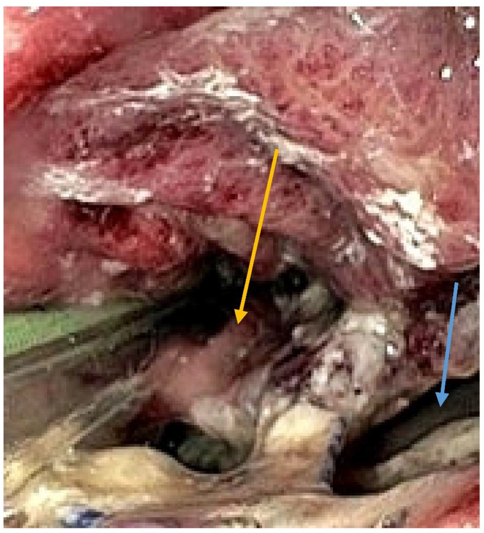 Diseases 10 00126 g002 Diseases 10 00126 g002