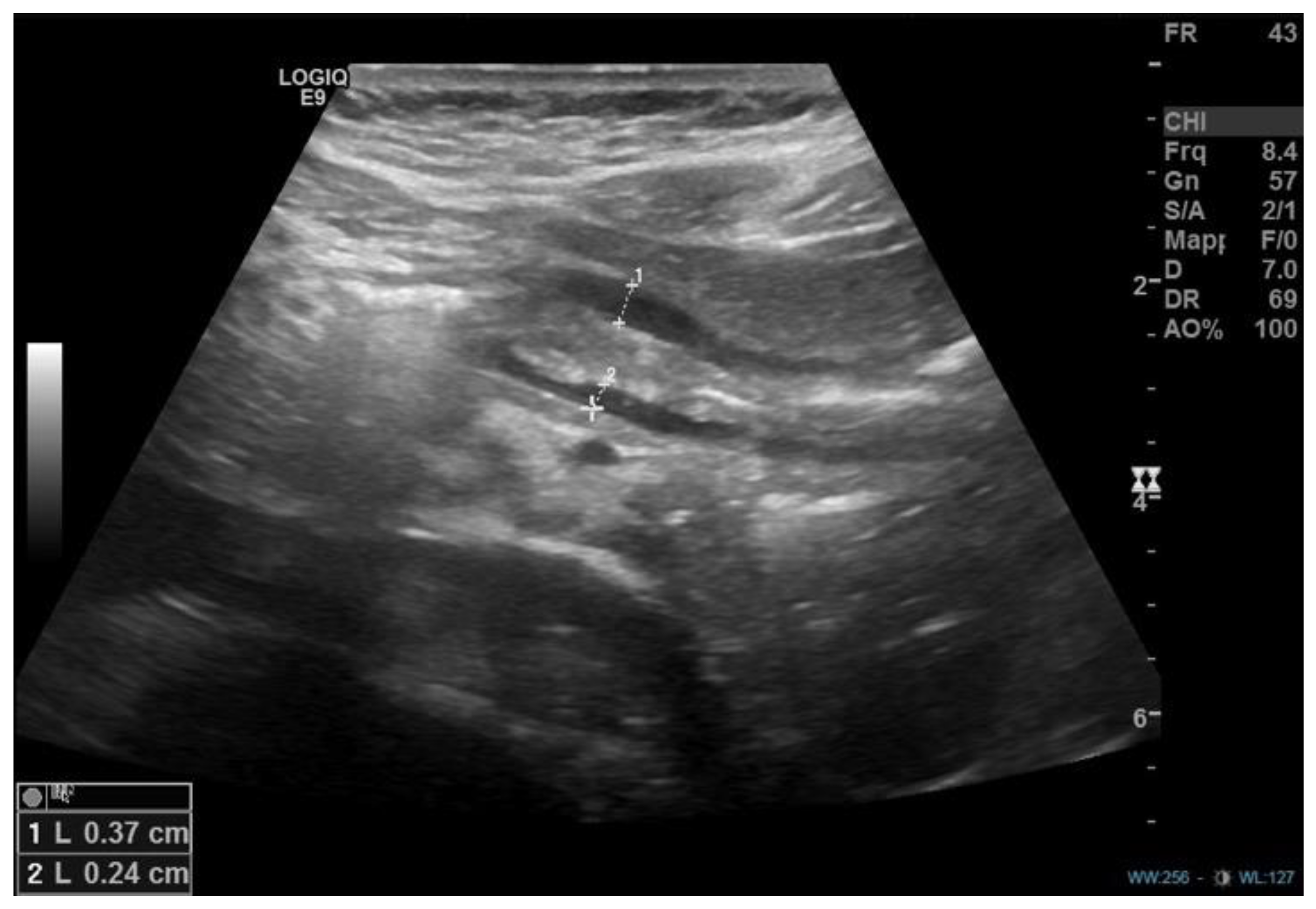 Diseases 11 00019 g005