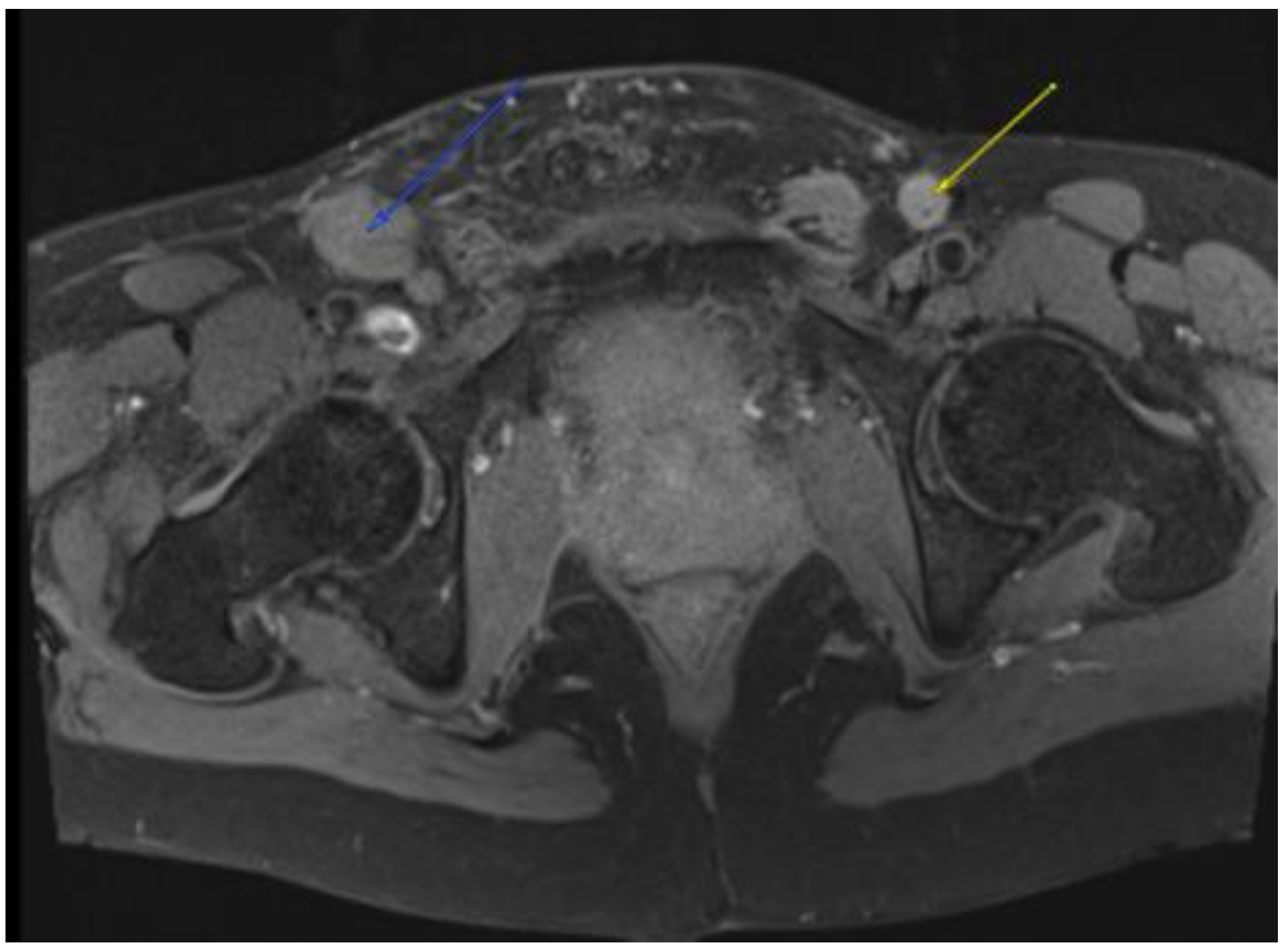 Diseases 11 00034 g005
