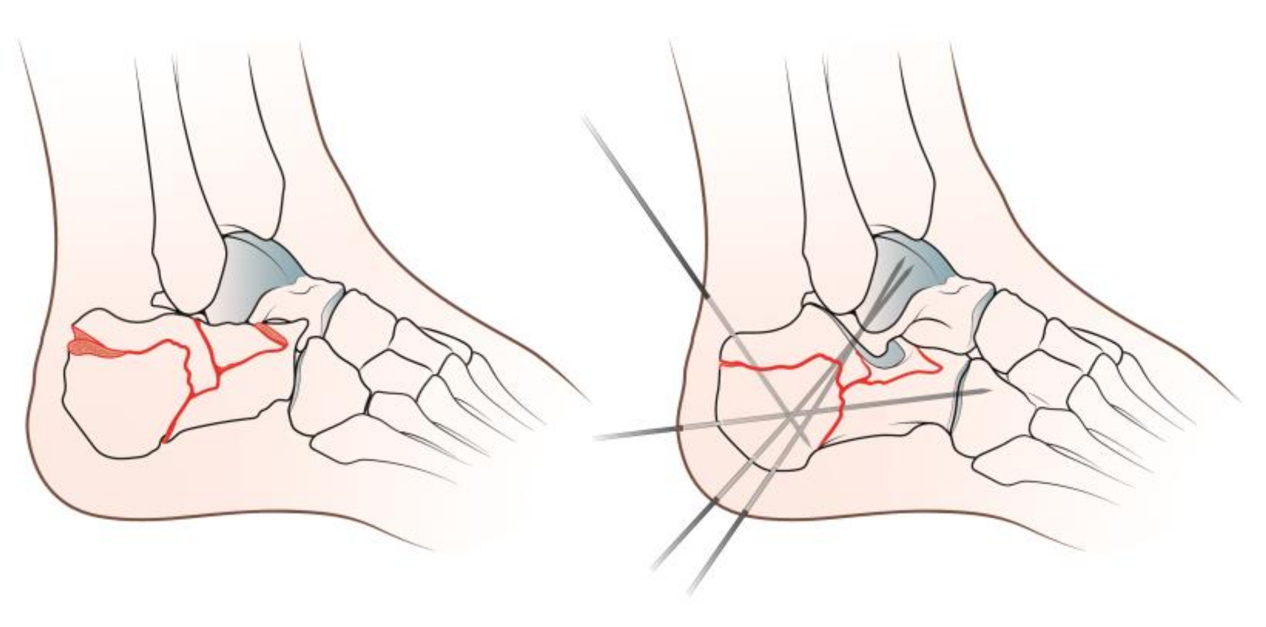 Diseases 11 00057 g001 Diseases 11 00057 g001