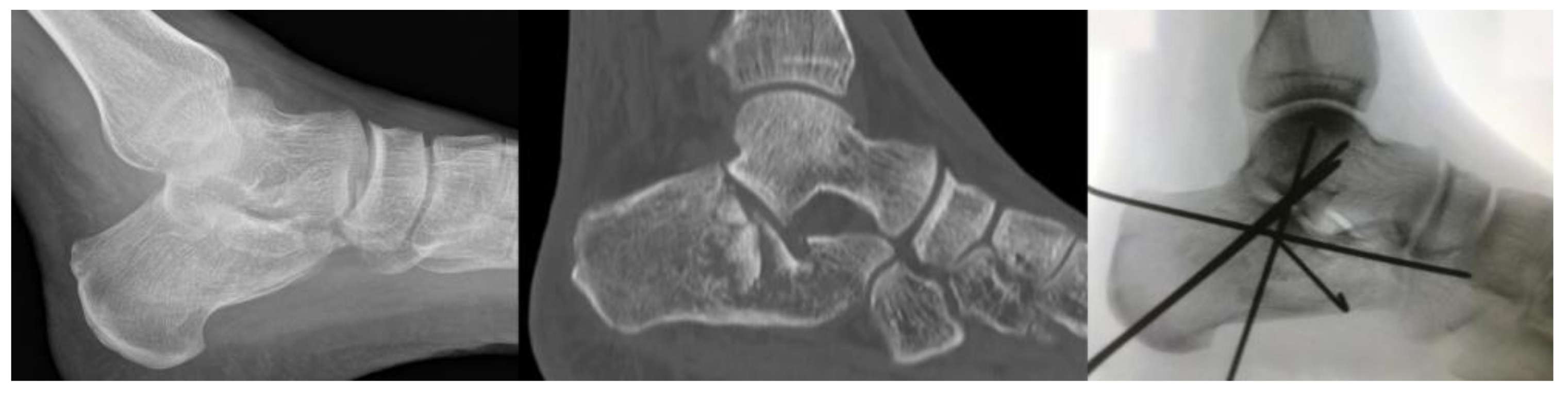 Diseases 11 00057 g002 Diseases 11 00057 g002