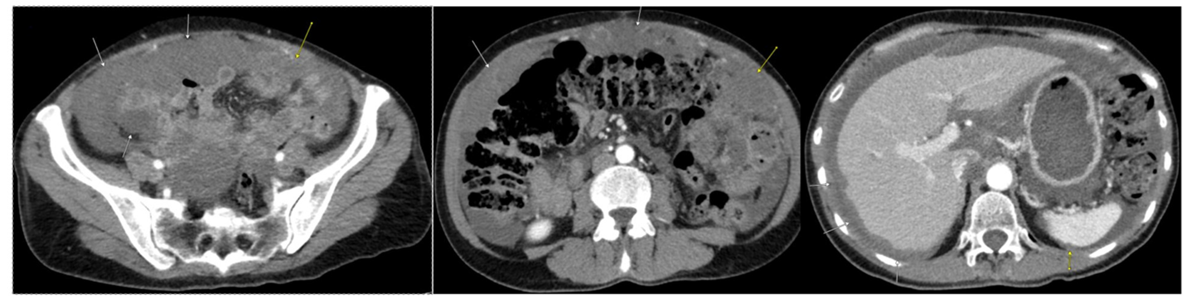 Diseases 11 00060 g001