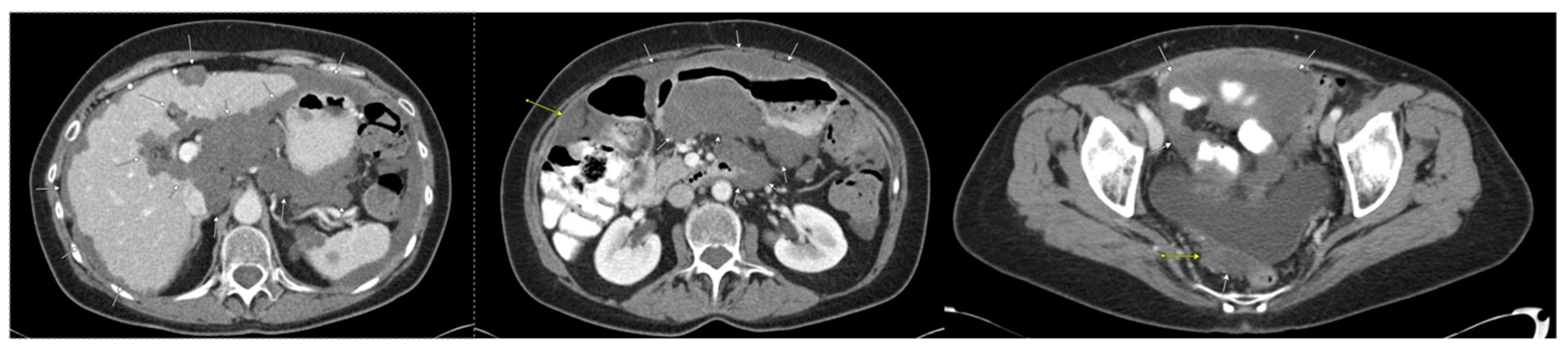 Diseases 11 00060 g004