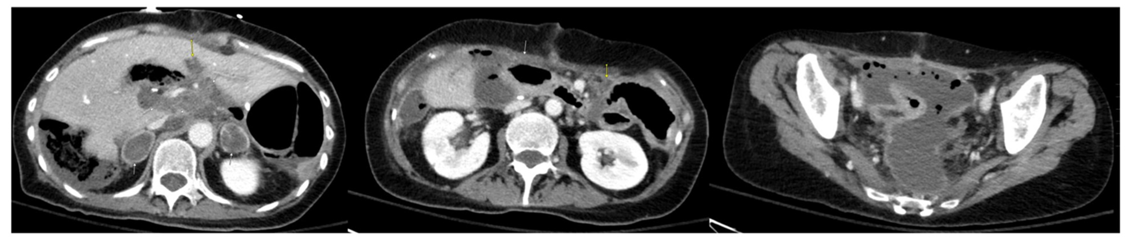 Diseases 11 00060 g005