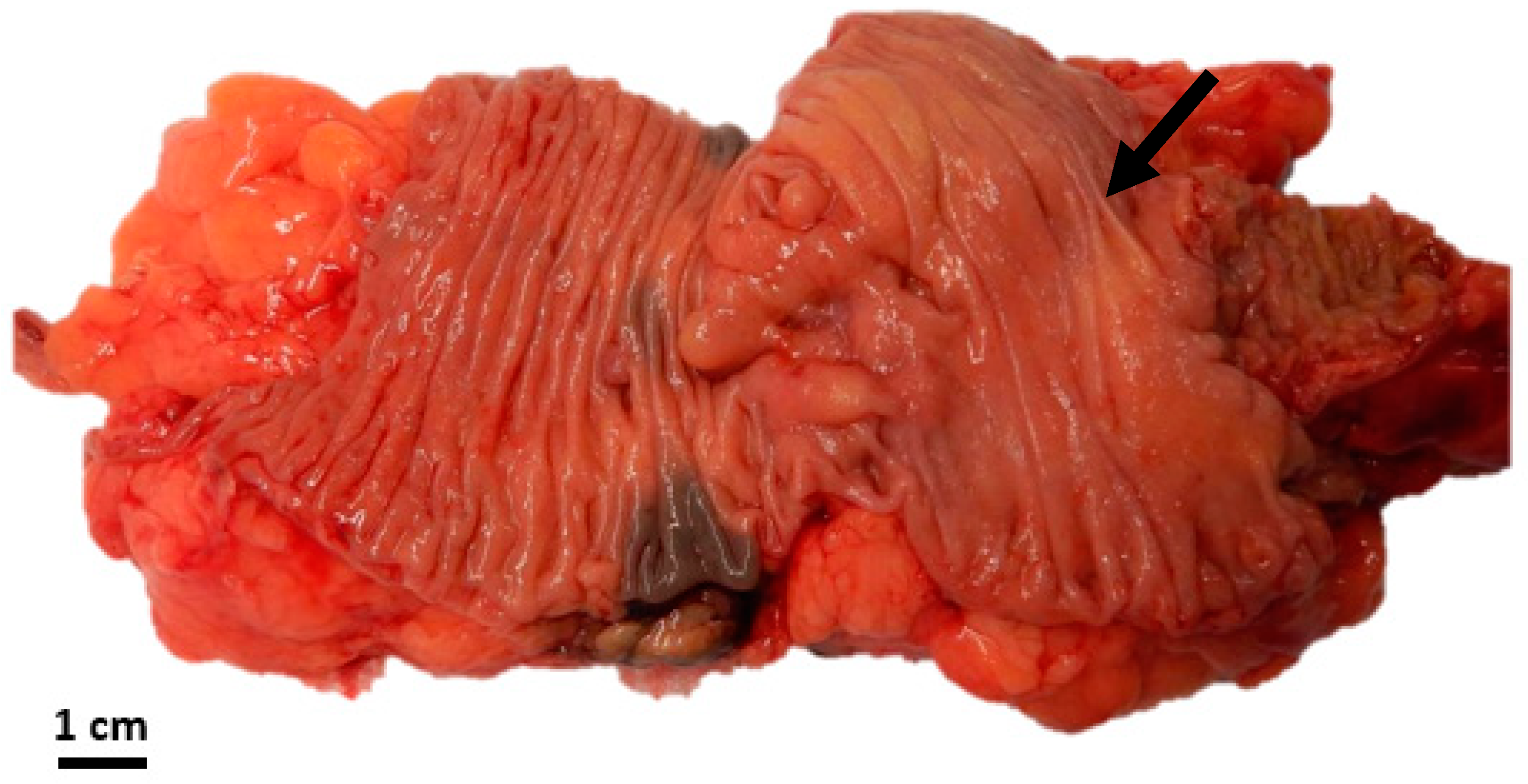 Diseases 11 00069 g004