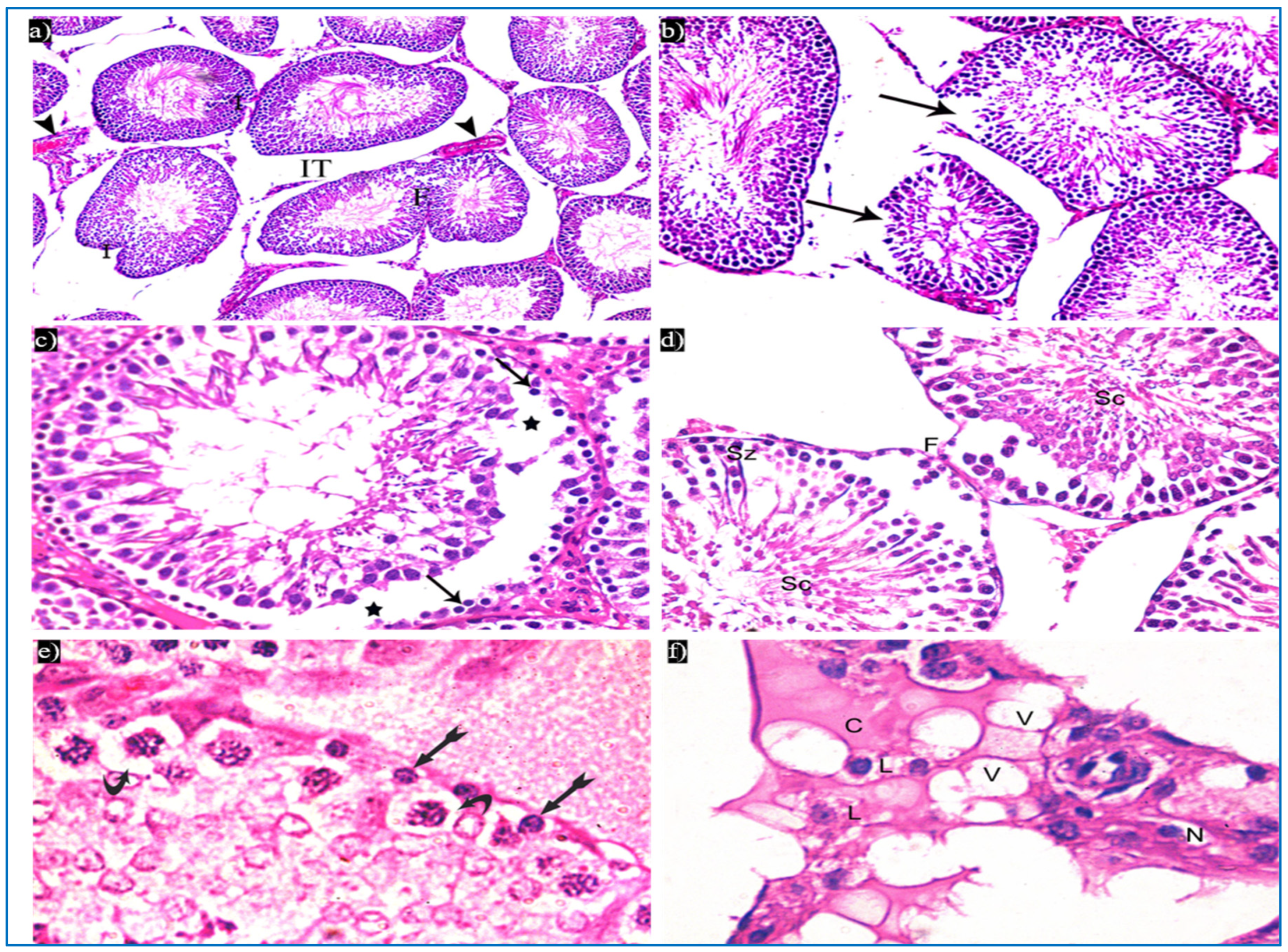 Diseases 11 00084 g004