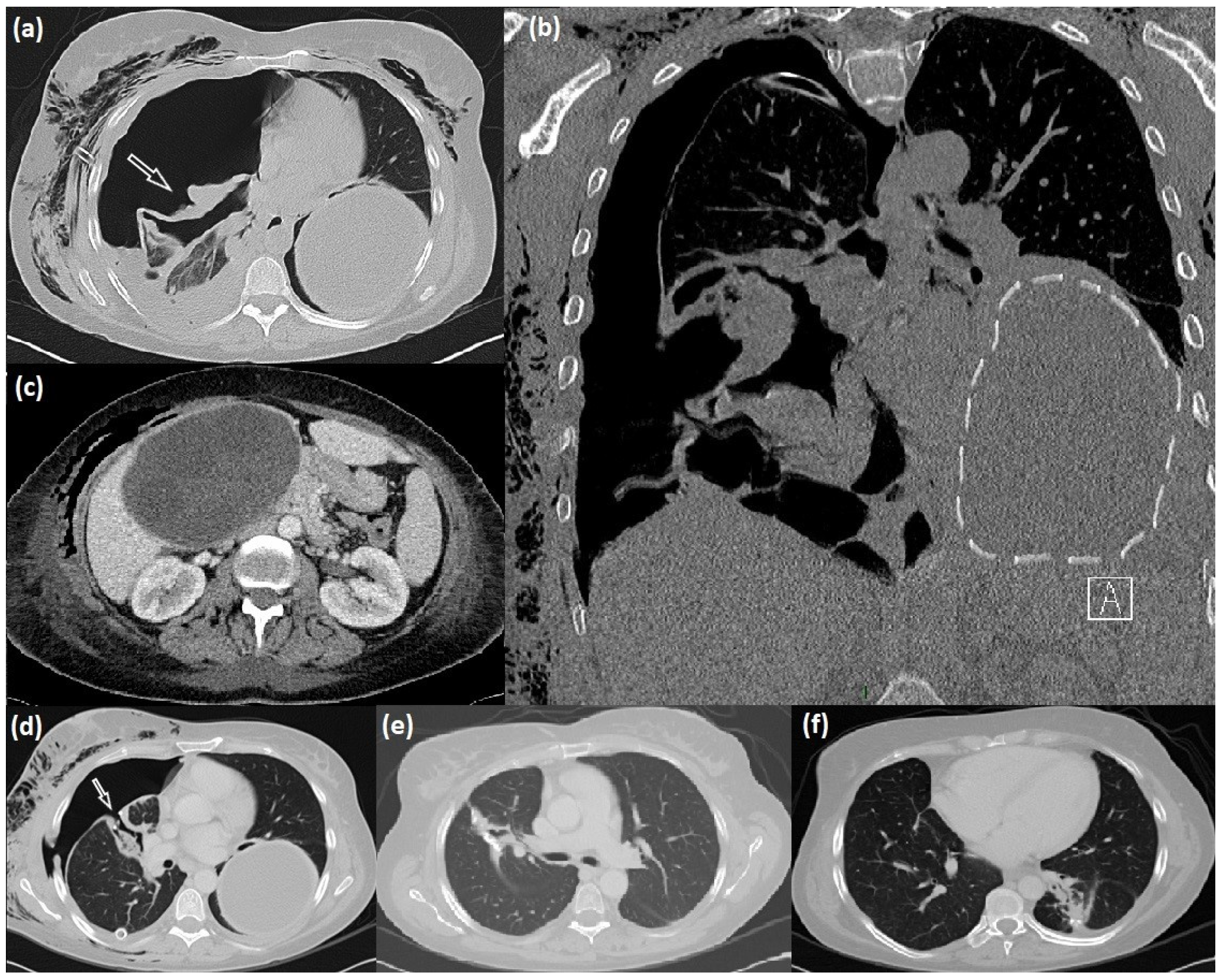 Diseases 11 00090 g001