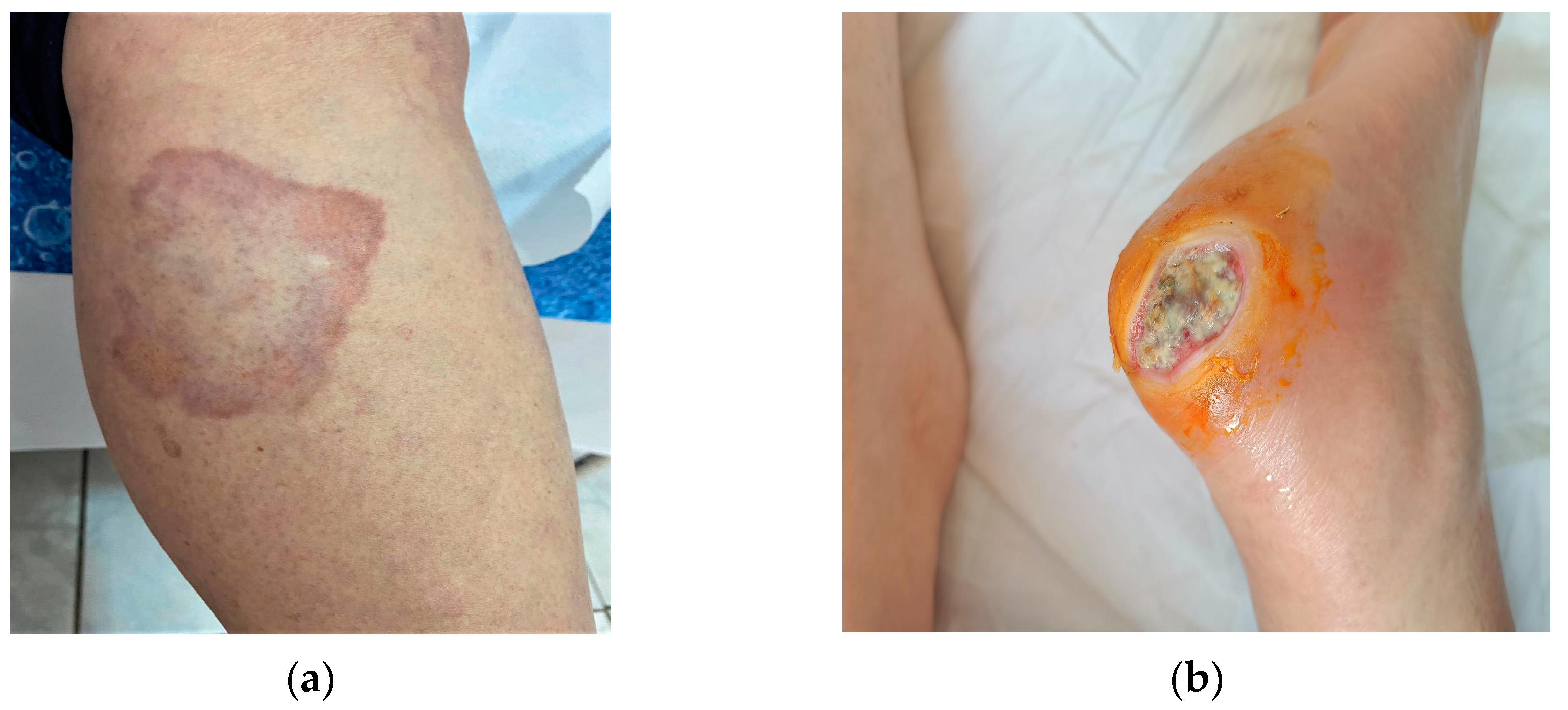 Diseases 11 00106 g001