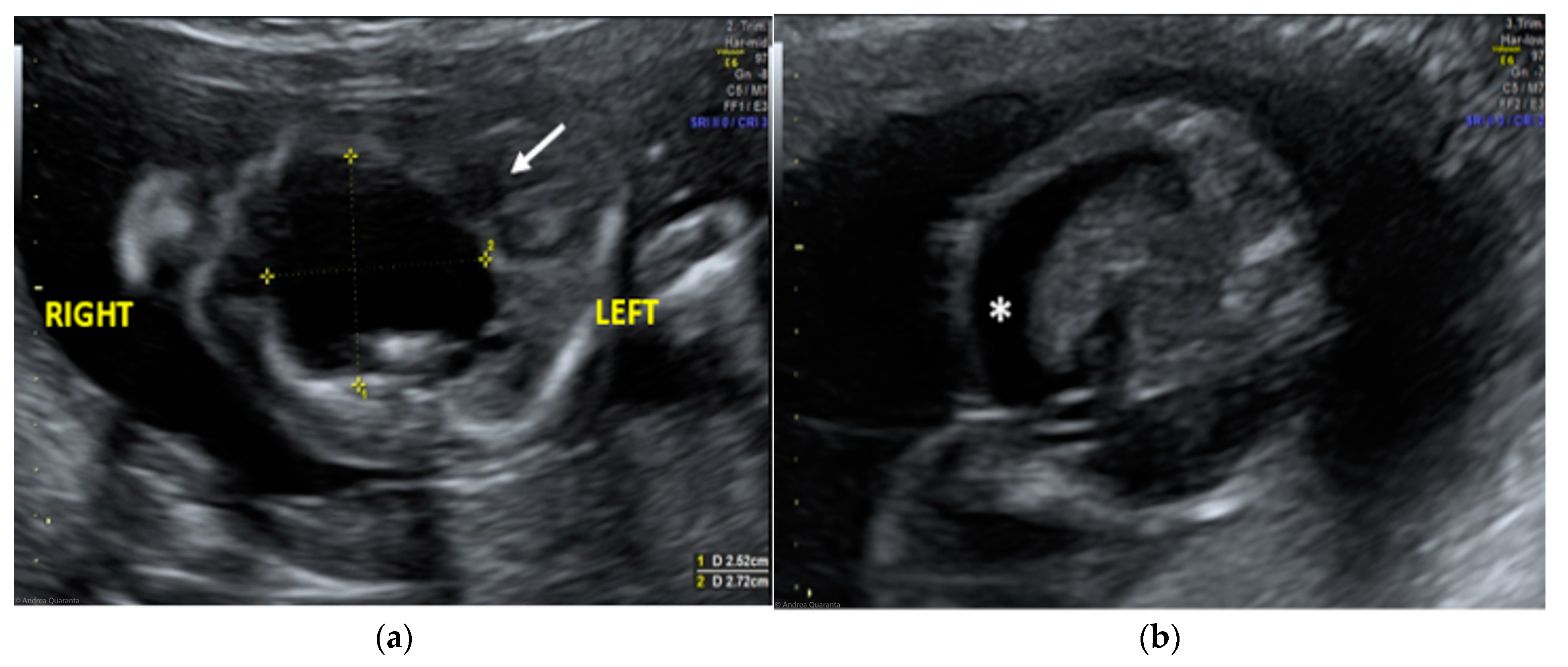 Diseases 11 00144 g001