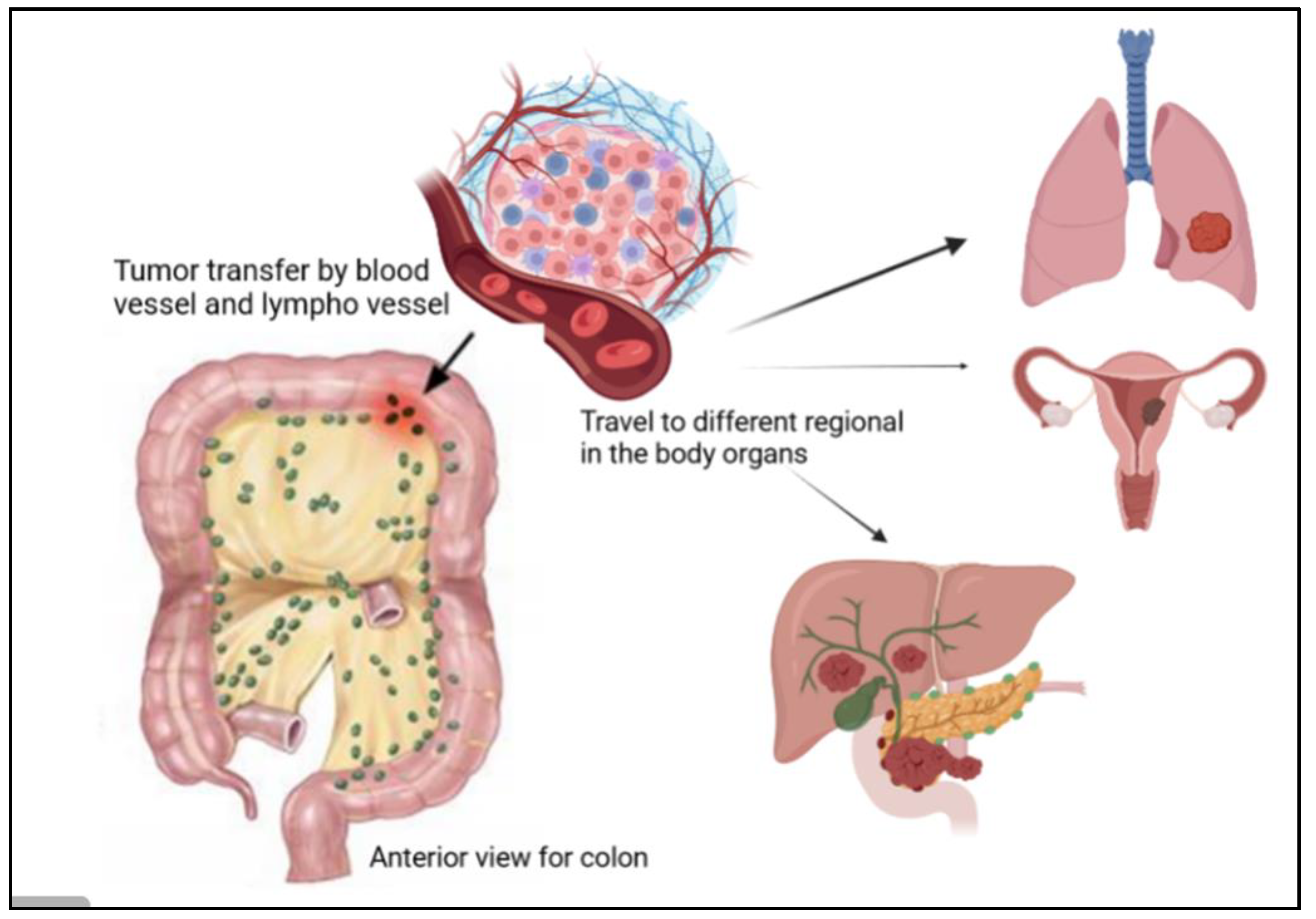 Diseases 11 00148 g005