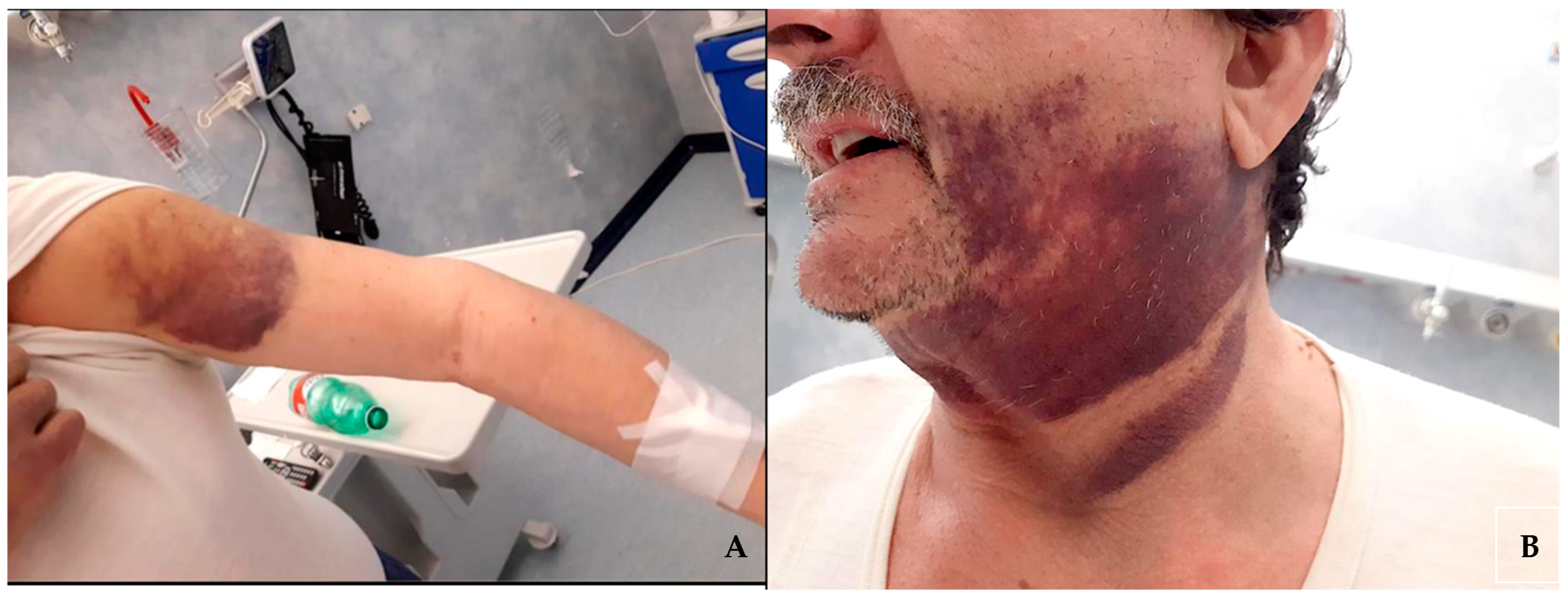 Diseases 12 00005 g001