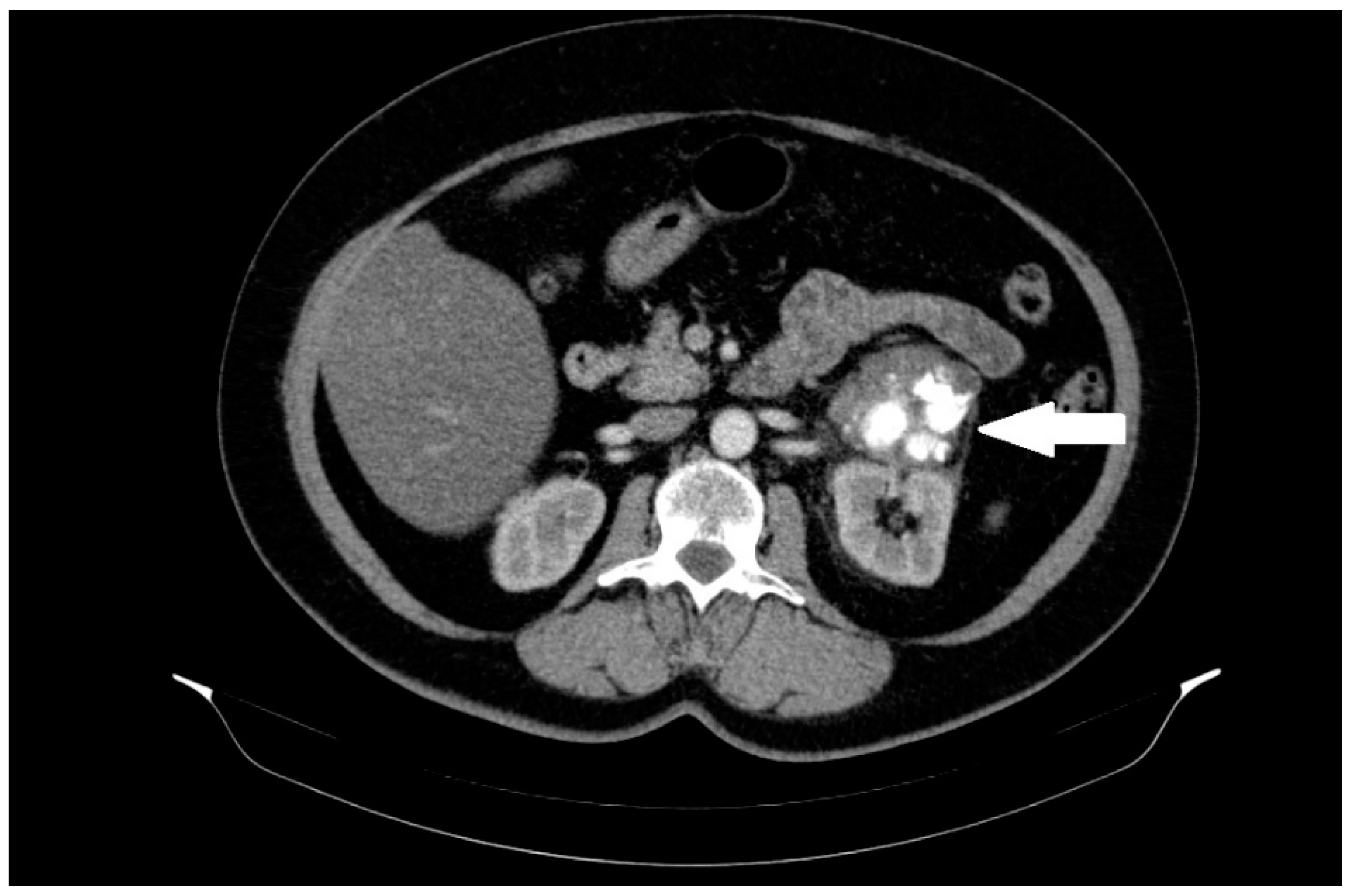 Diseases 12 00006 g001