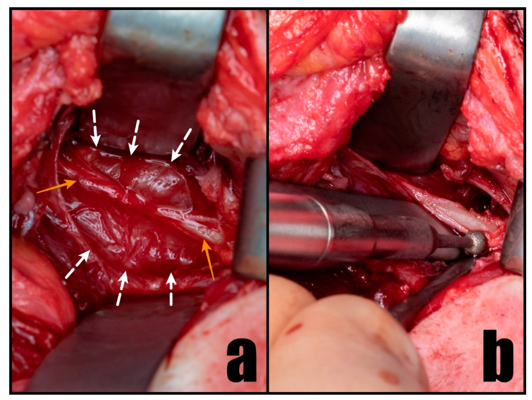 Diseases 12 00024 g003 Diseases 12 00024 g003