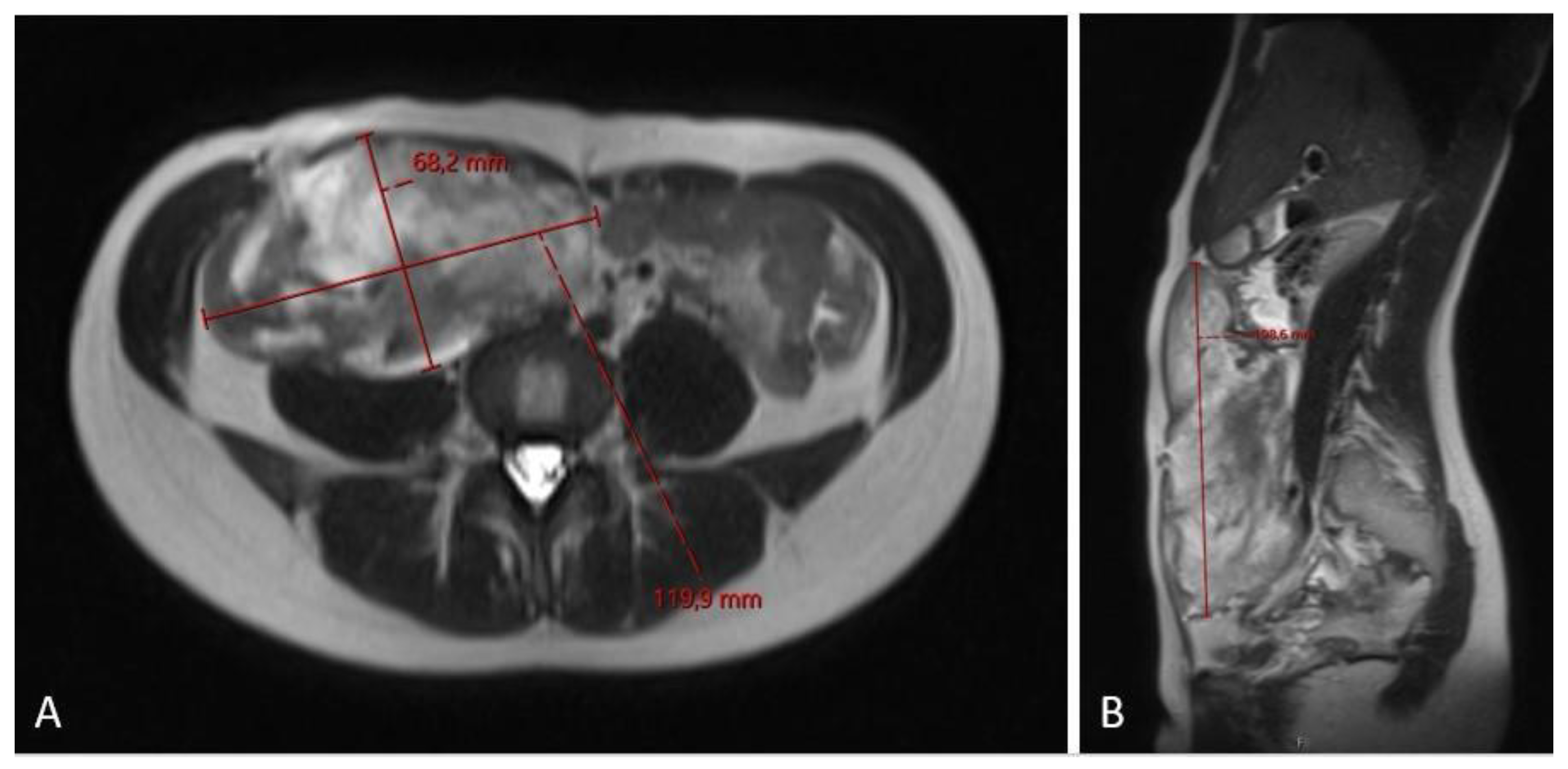 Diseases 12 00027 g005 Diseases 12 00027 g005