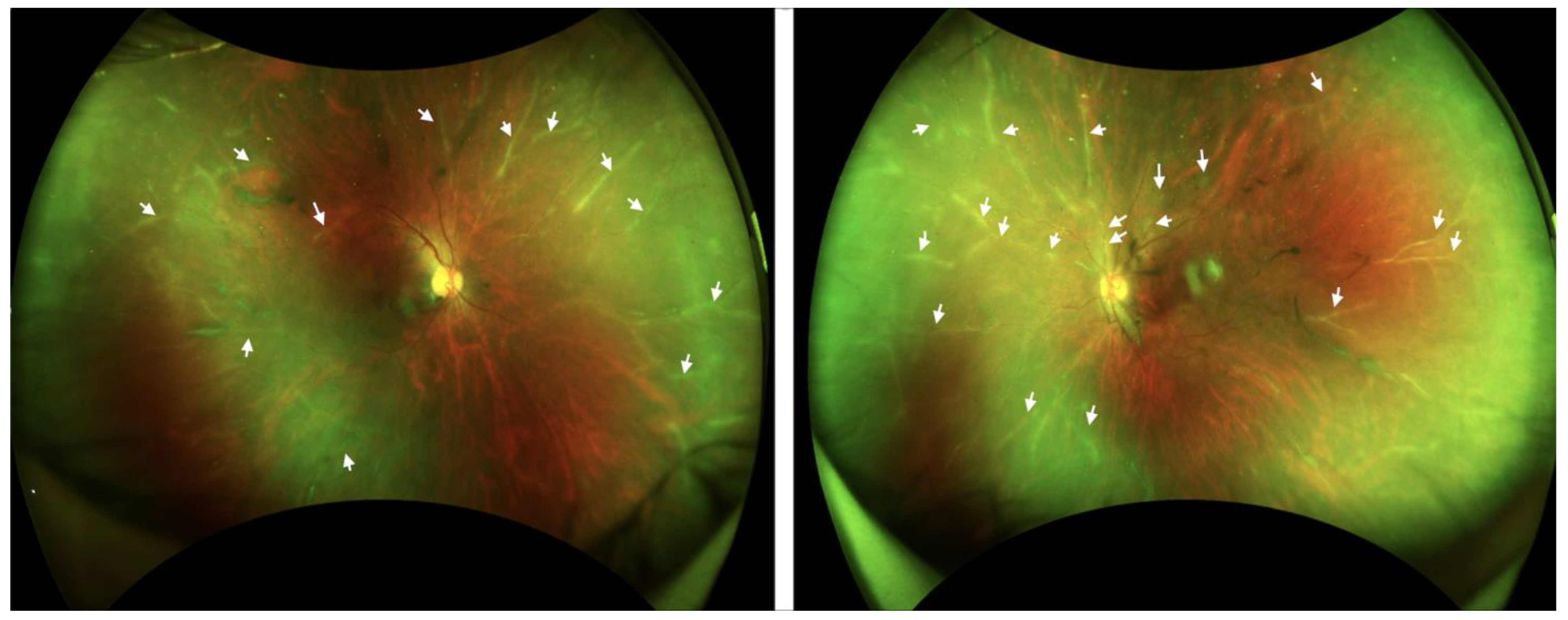 Diseases 12 00036 g001