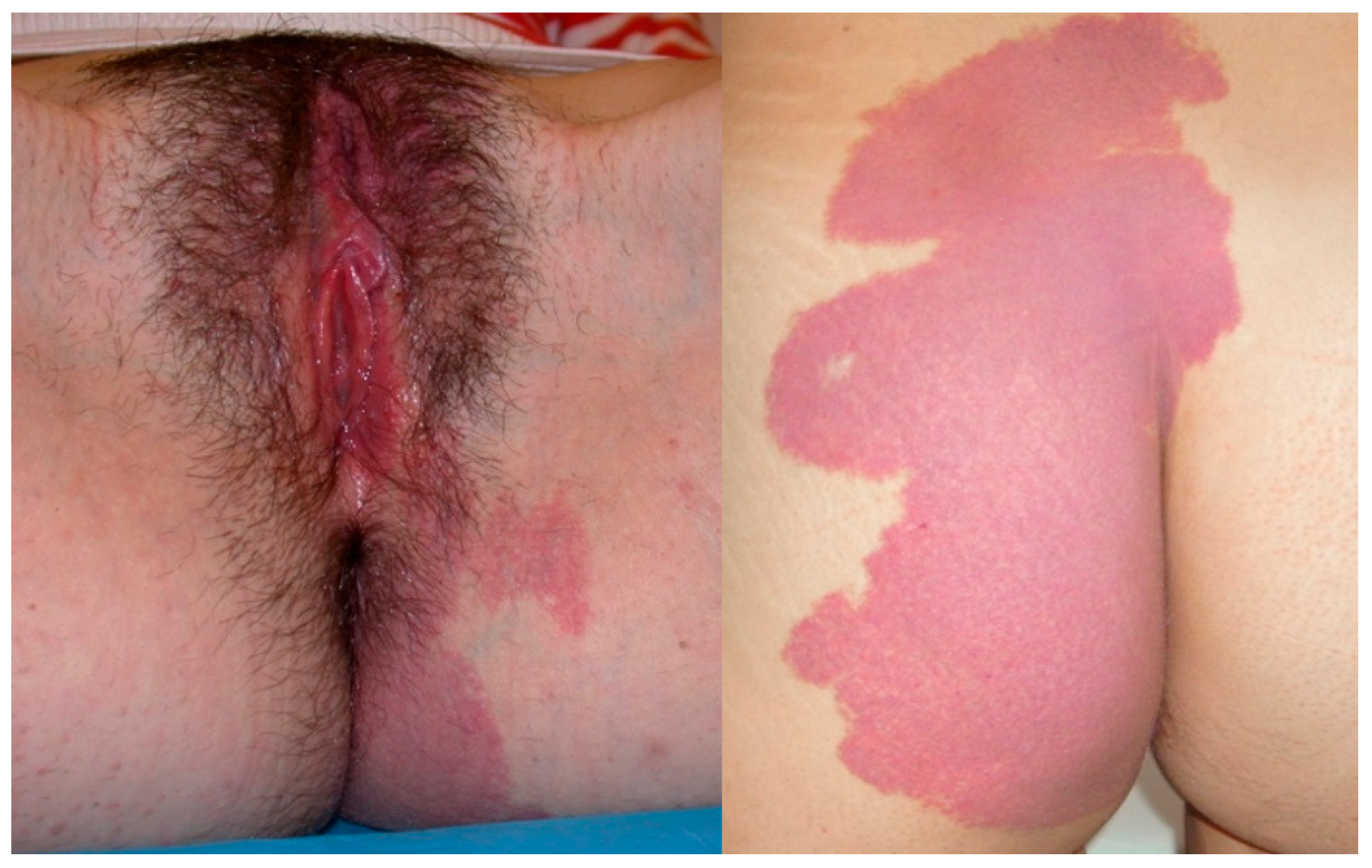 Diseases 12 00048 g001b