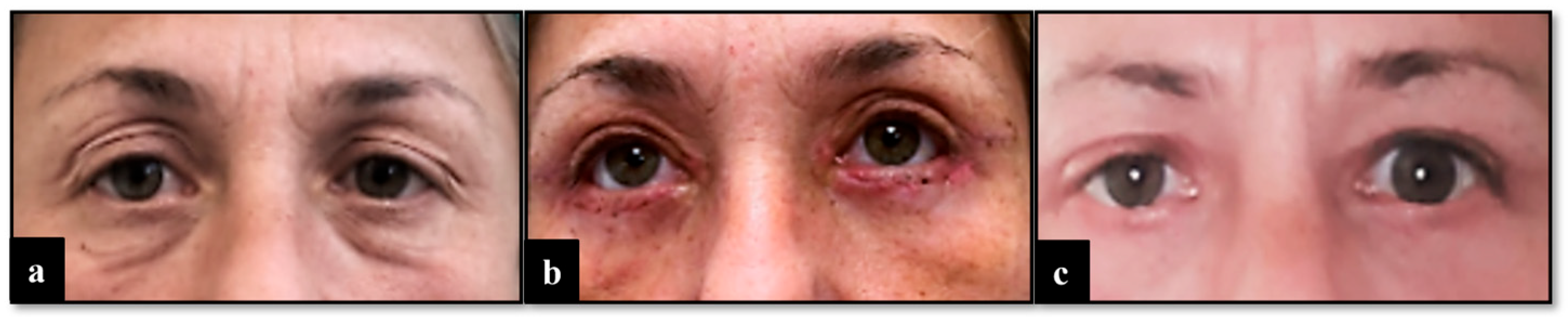 Diseases 12 00075 g001