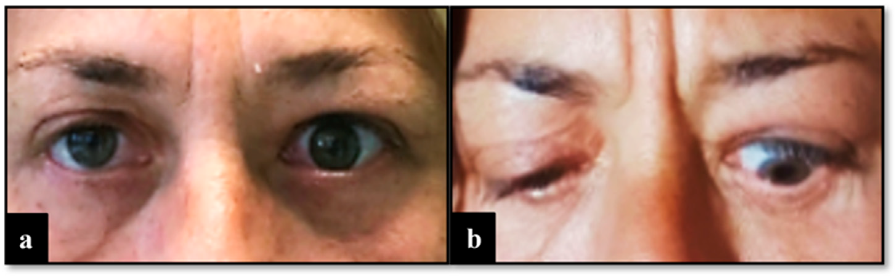 Diseases 12 00075 g002