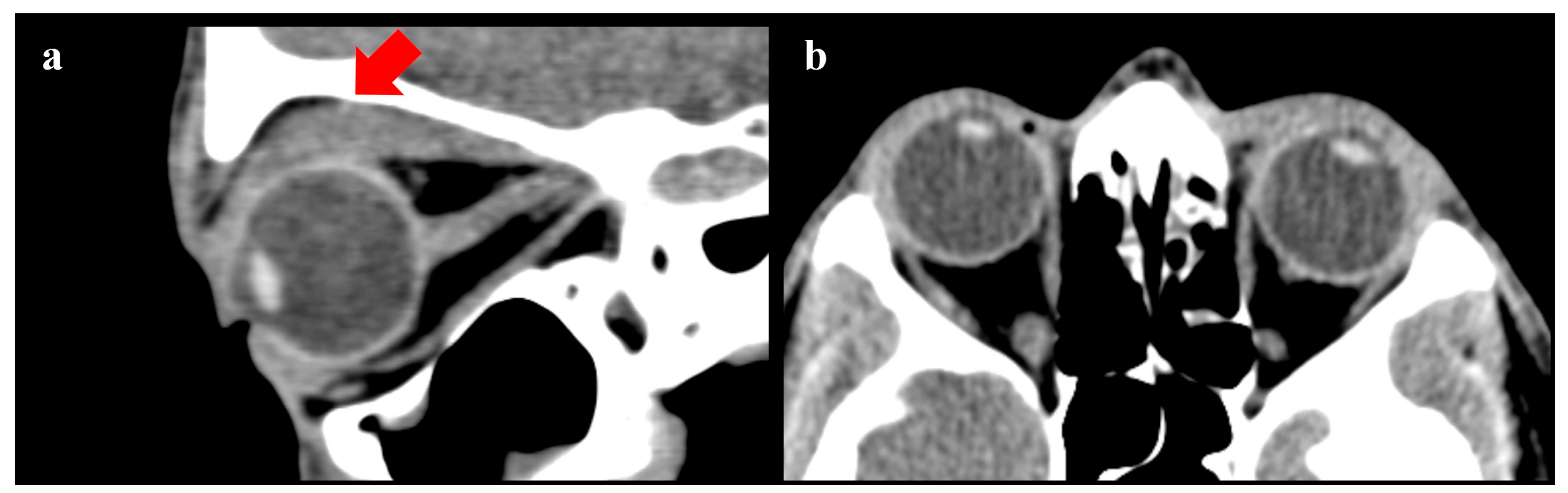 Diseases 12 00075 g003