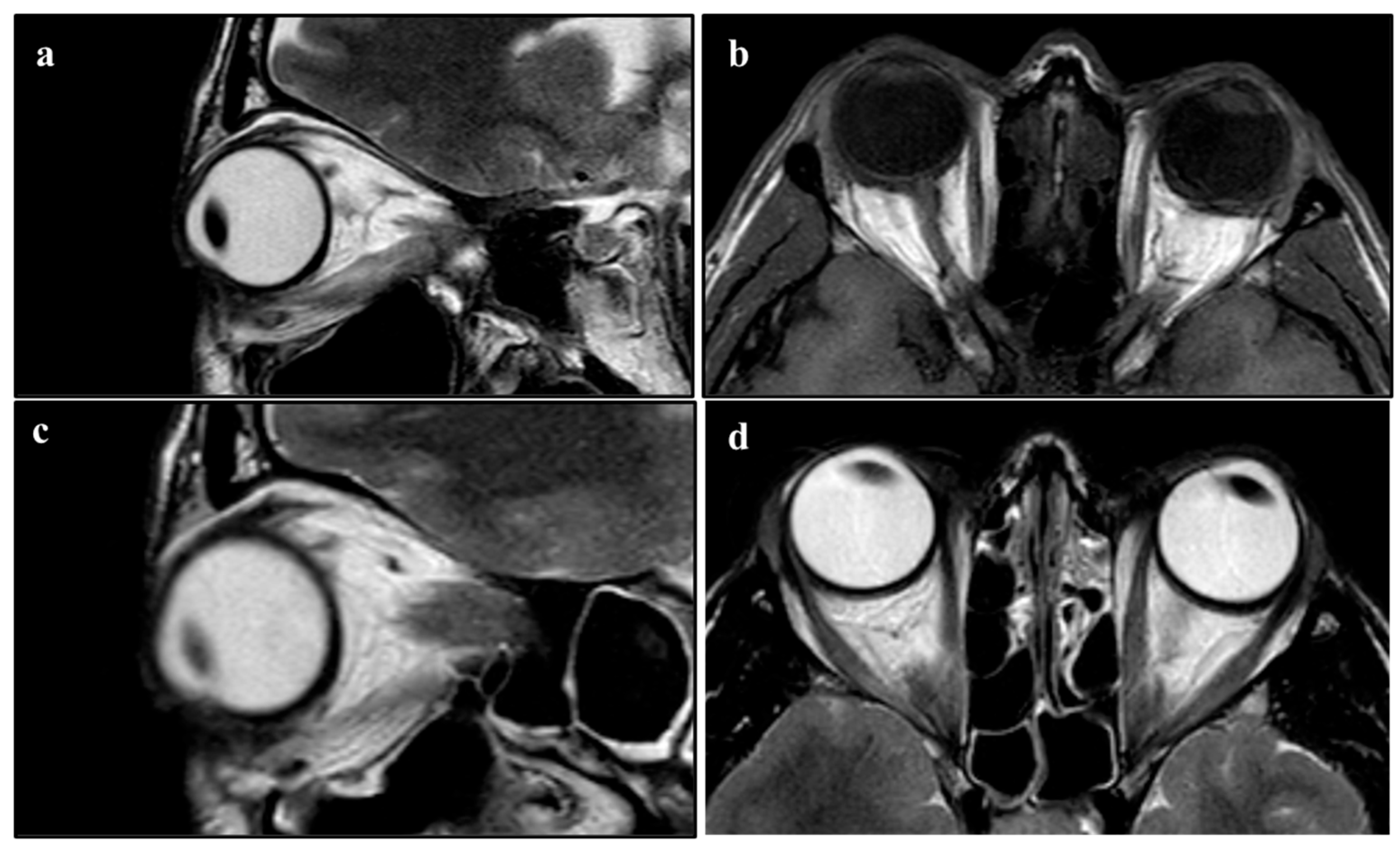 Diseases 12 00075 g004