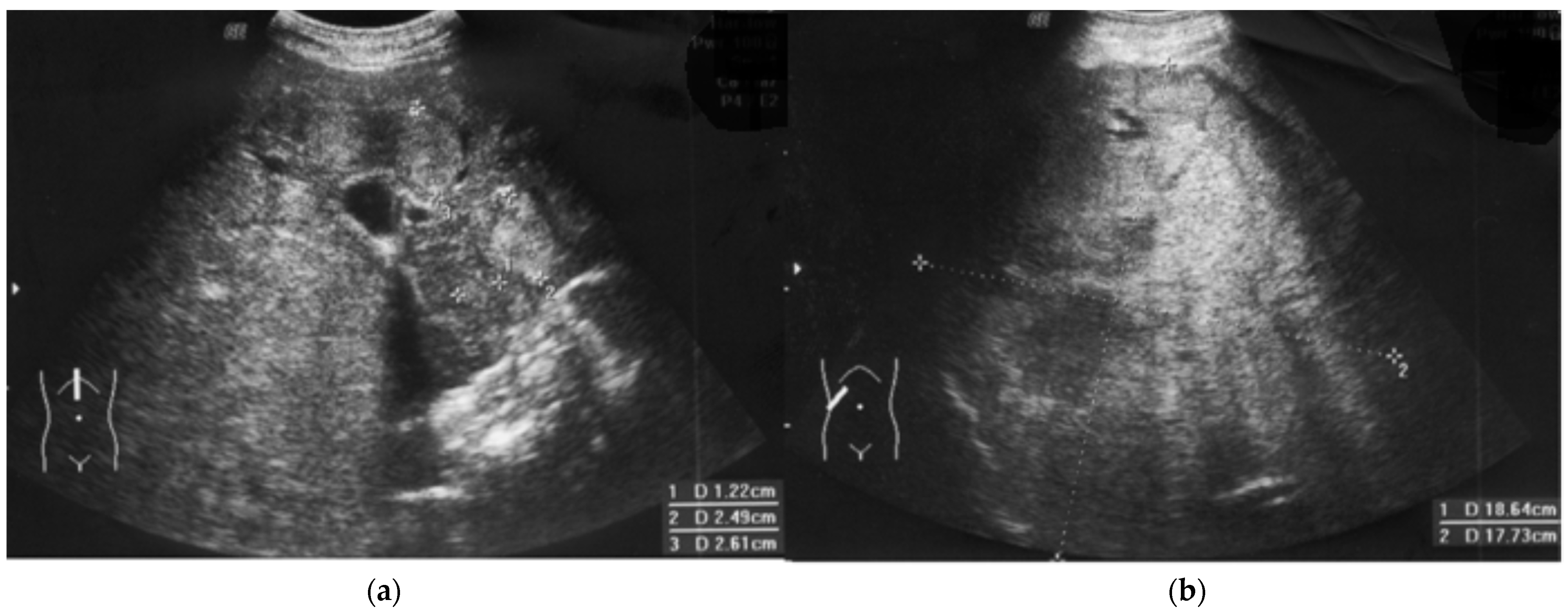 Diseases 12 00080 g002