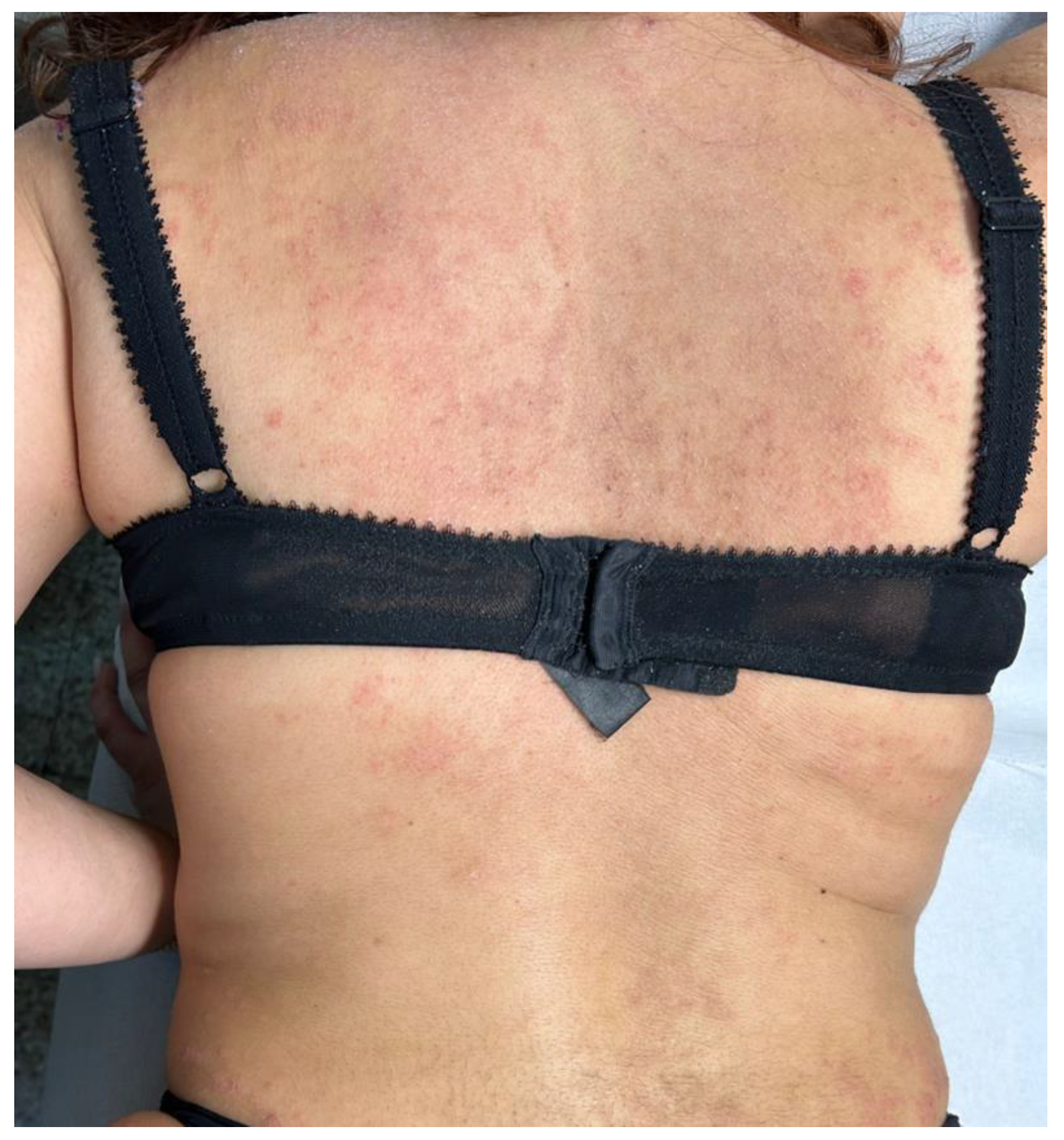 Diseases 12 00094 g001