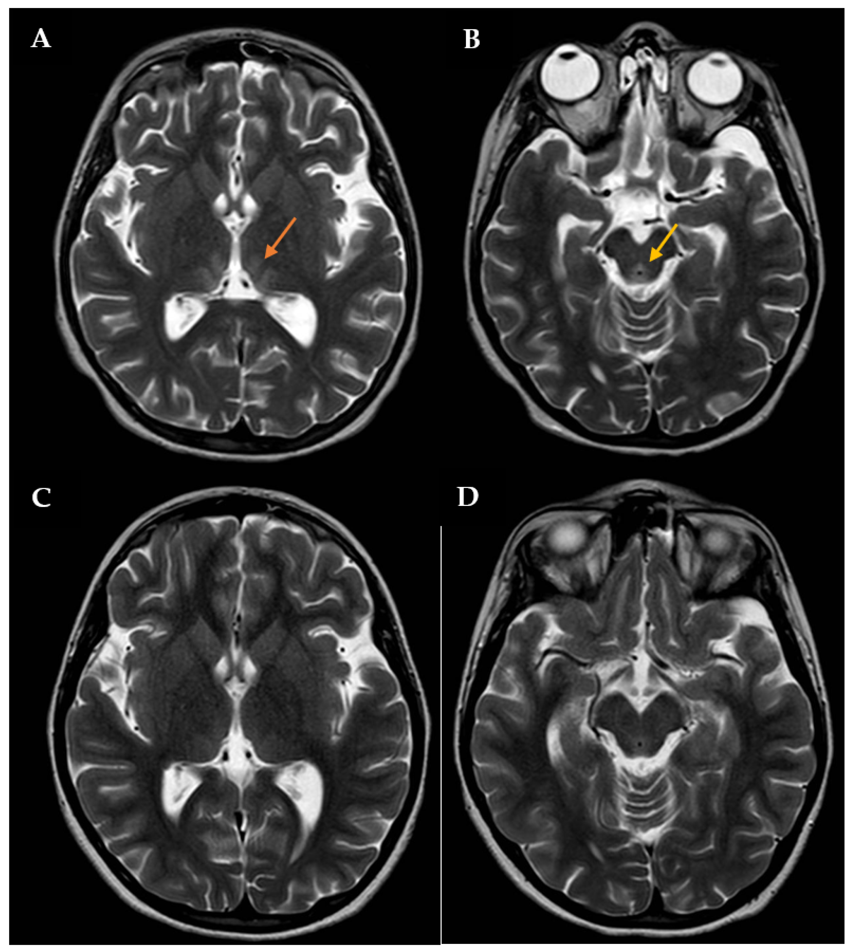 Diseases 12 00112 g001