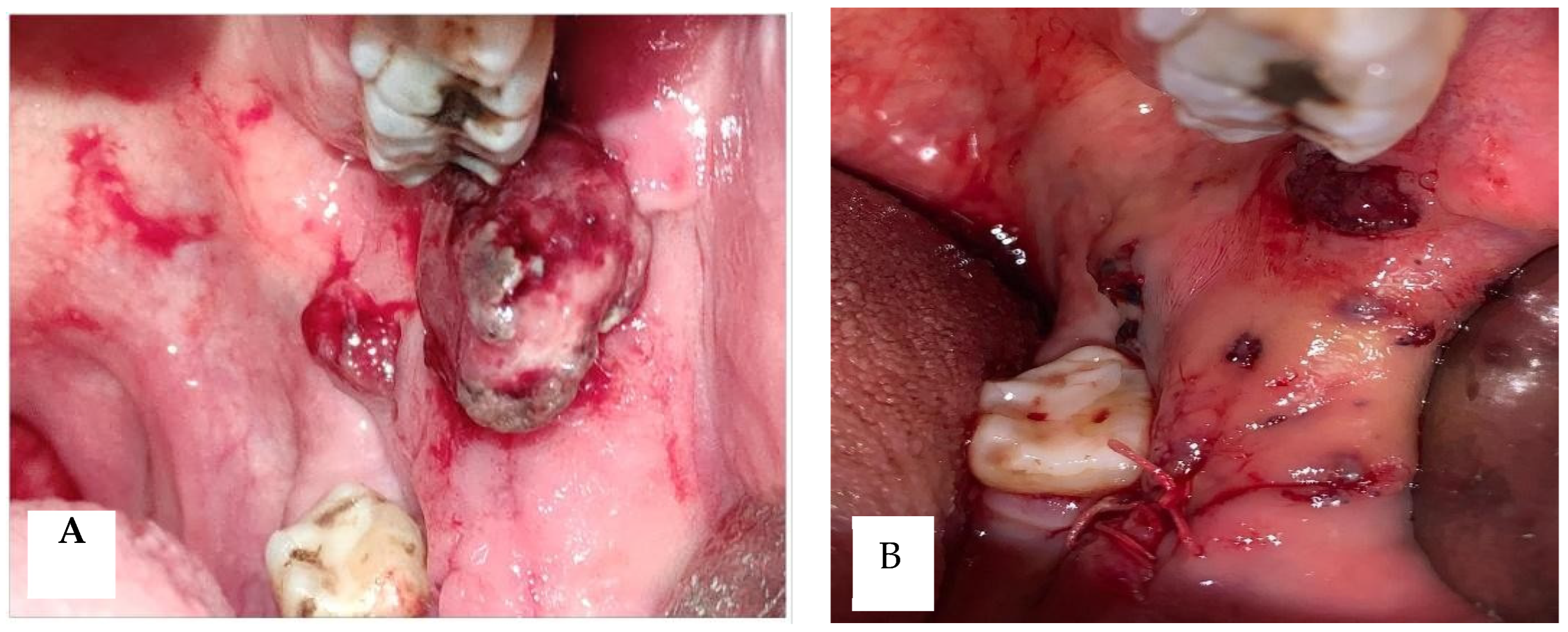 Diseases 12 00117 g001