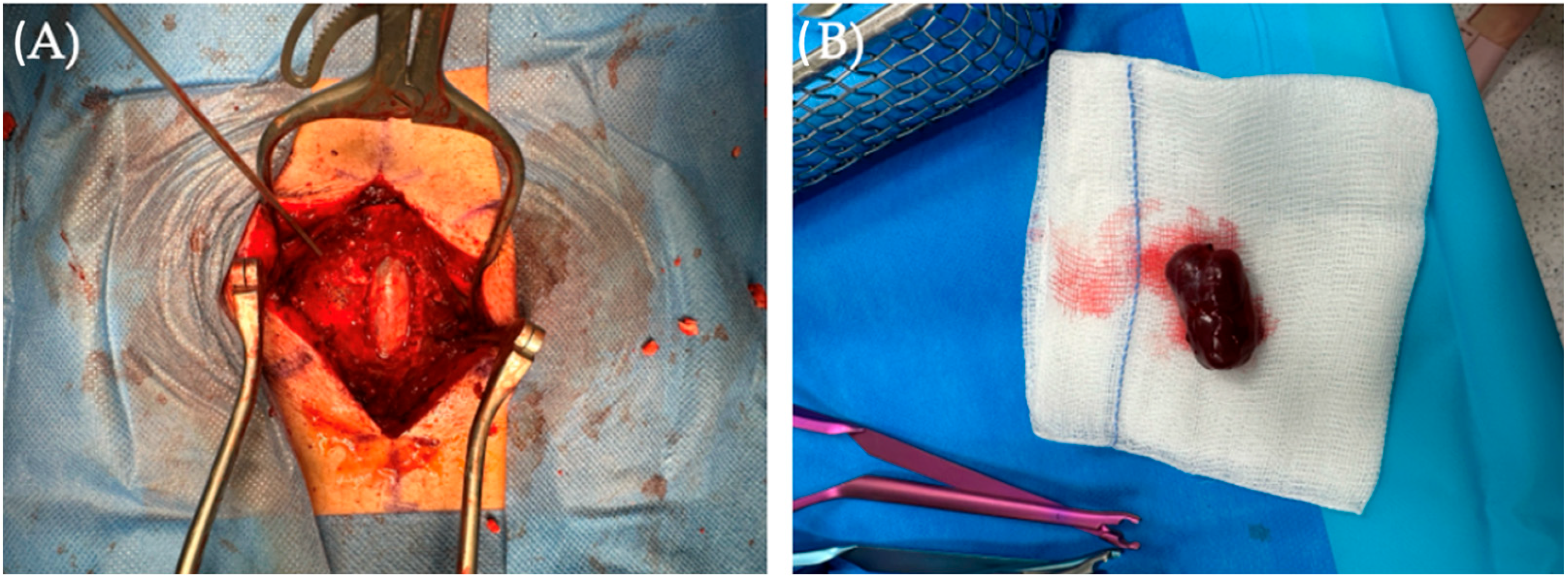 Diseases 12 00132 g001