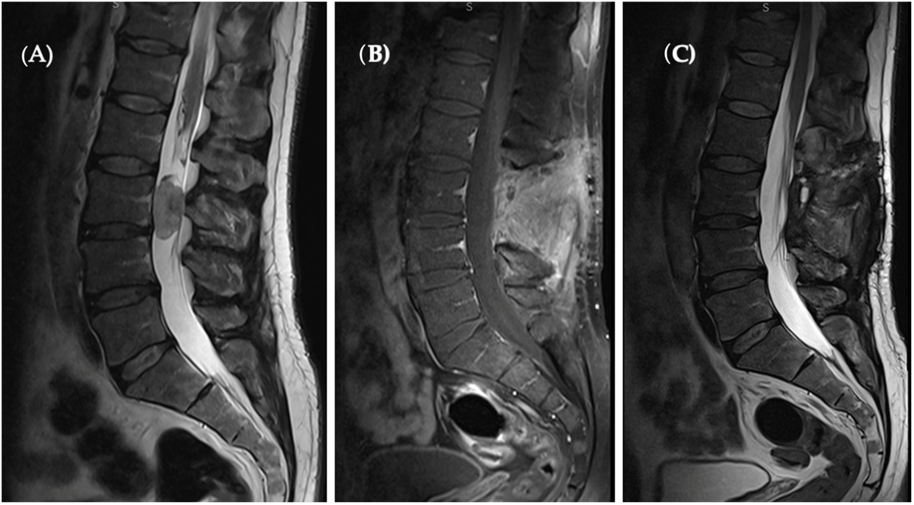 Diseases 12 00132 g003