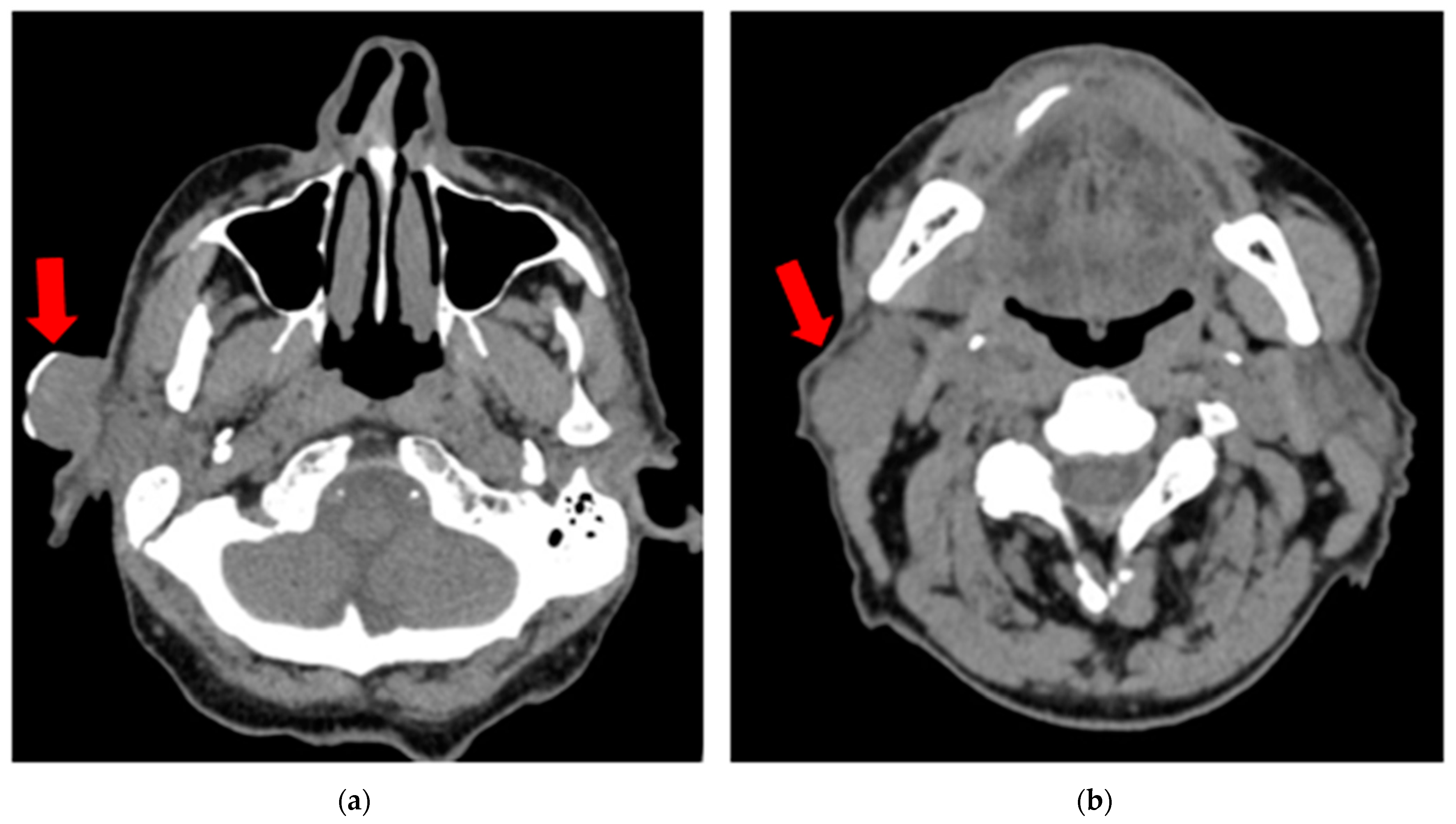 Diseases 12 00140 g002