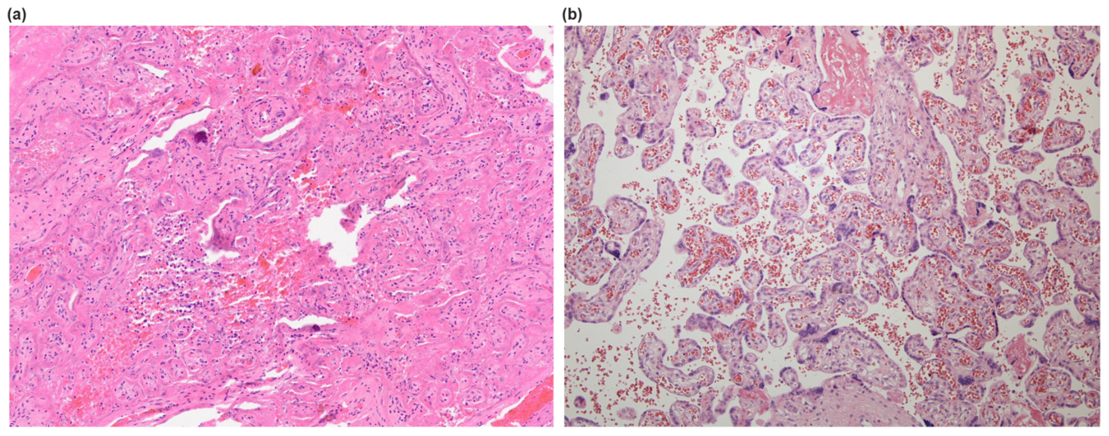 Diseases 12 00142 g001