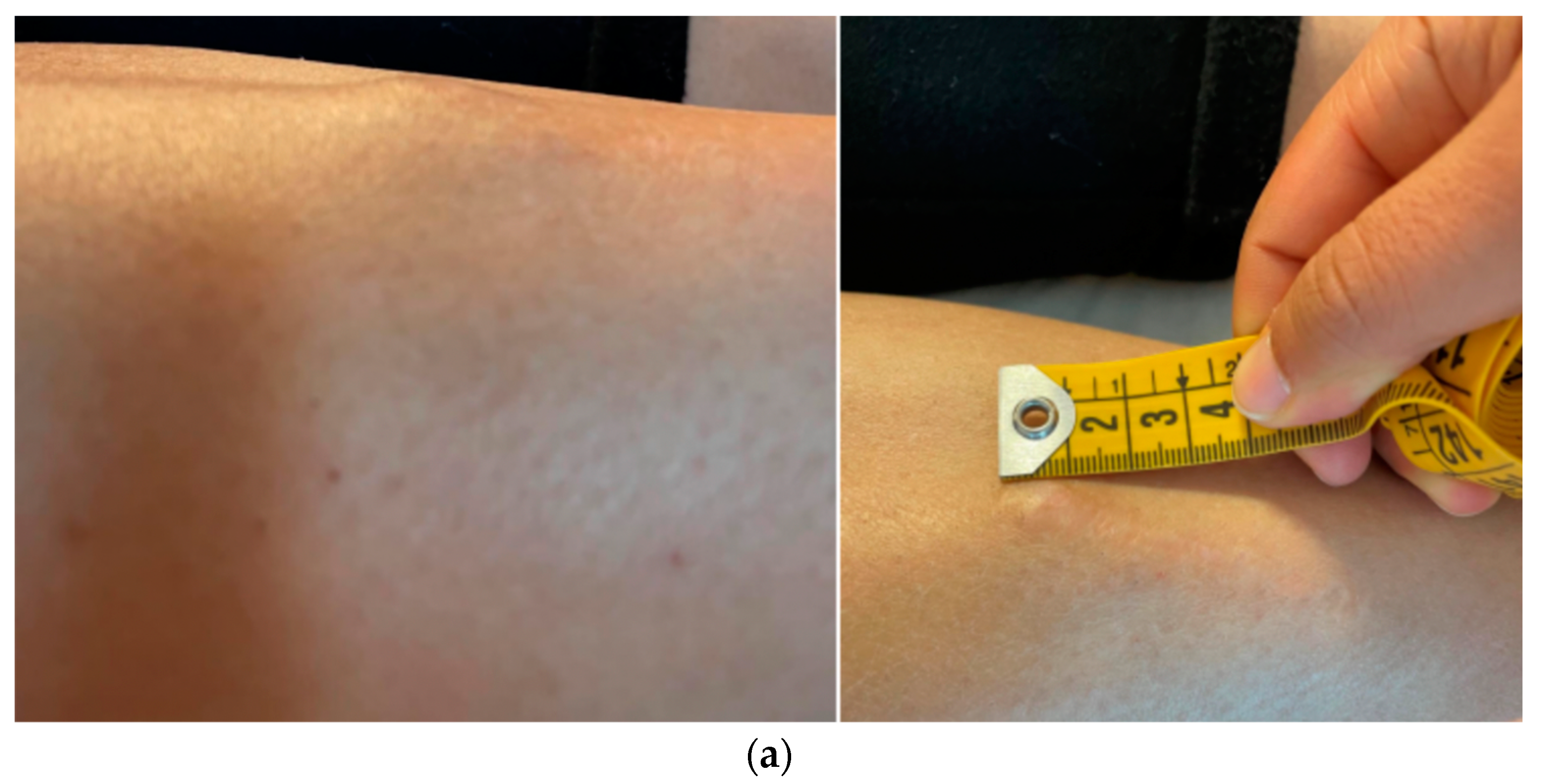 Diseases 12 00164 g001a