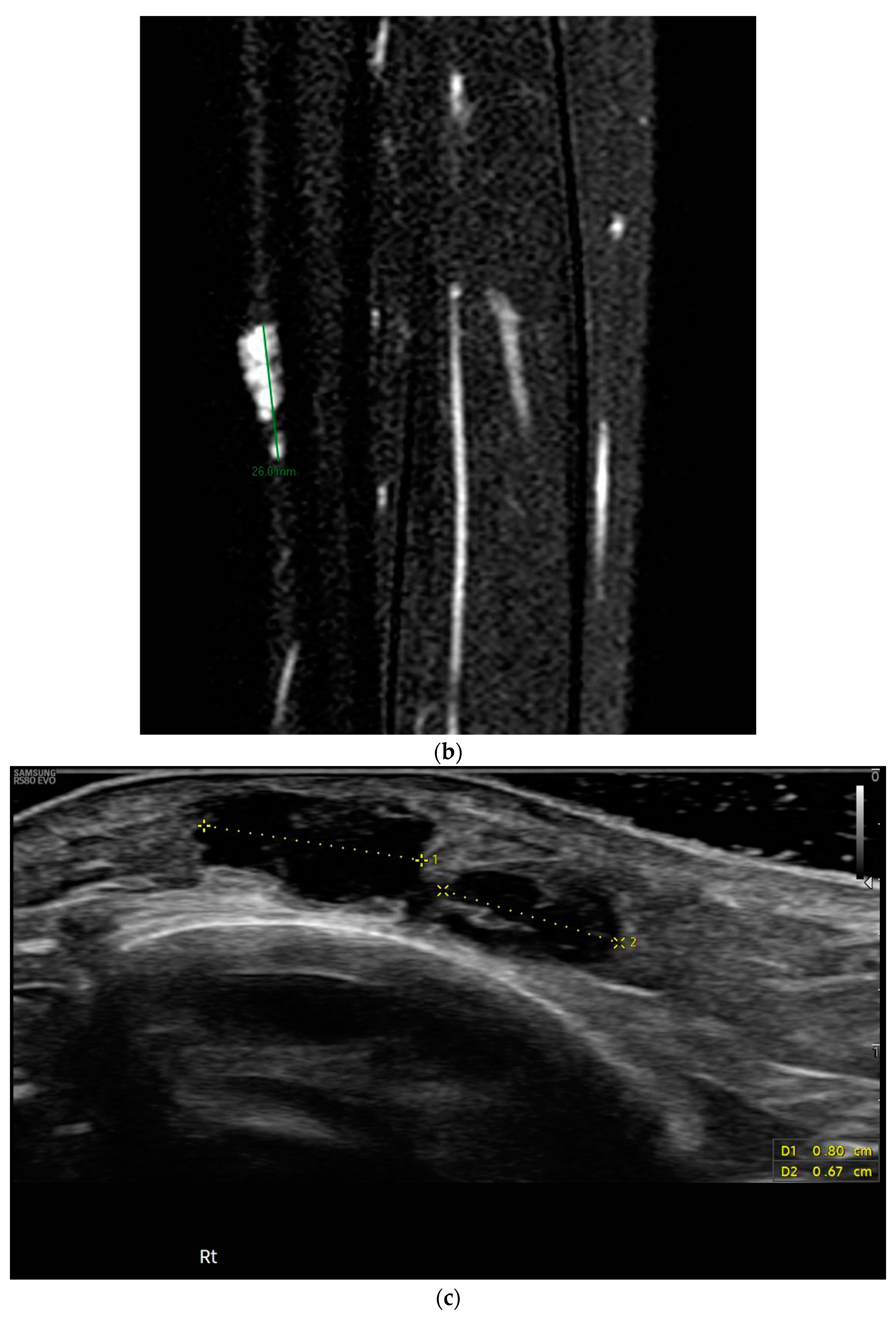 Diseases 12 00164 g001b