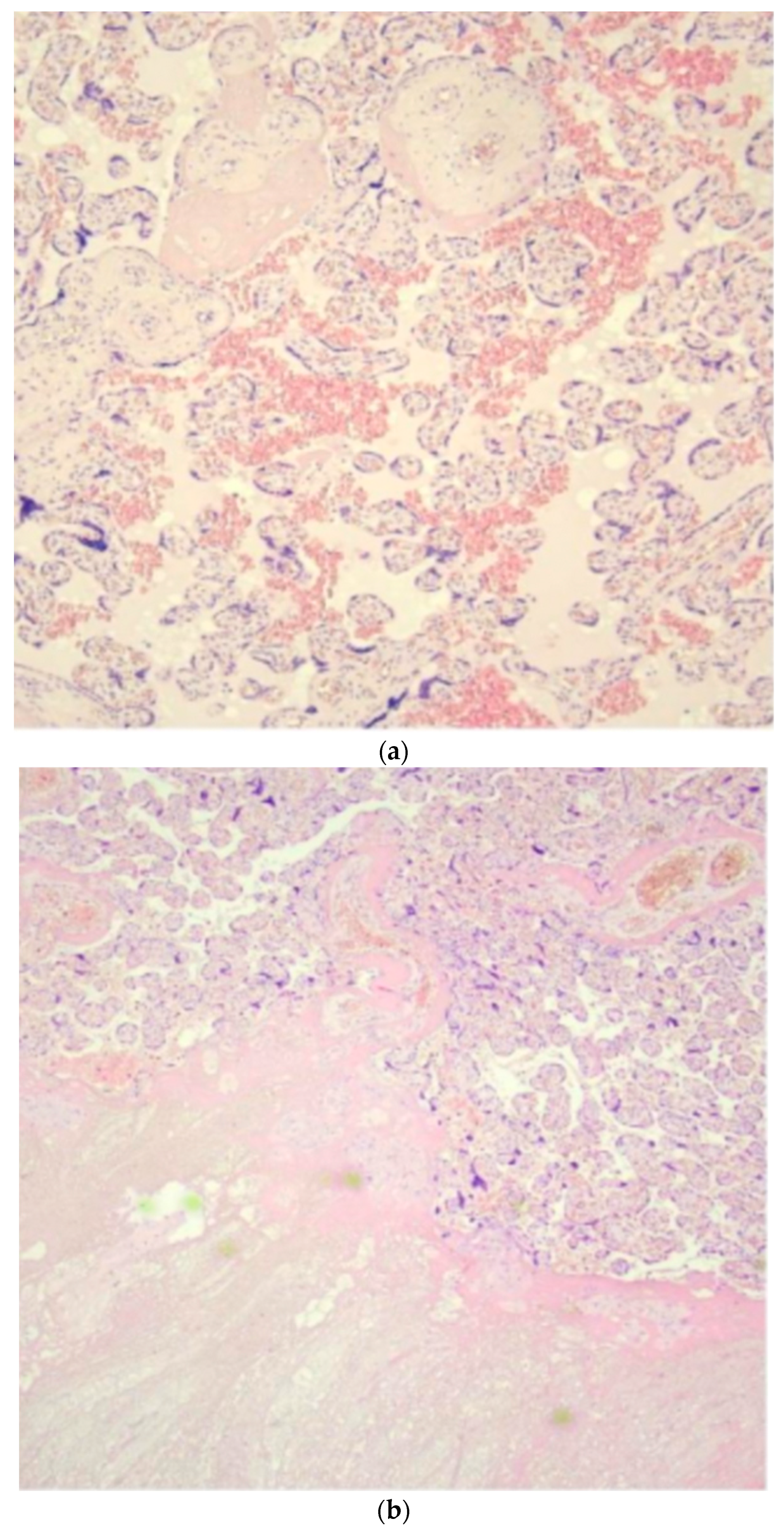 Diseases 12 00164 g002a