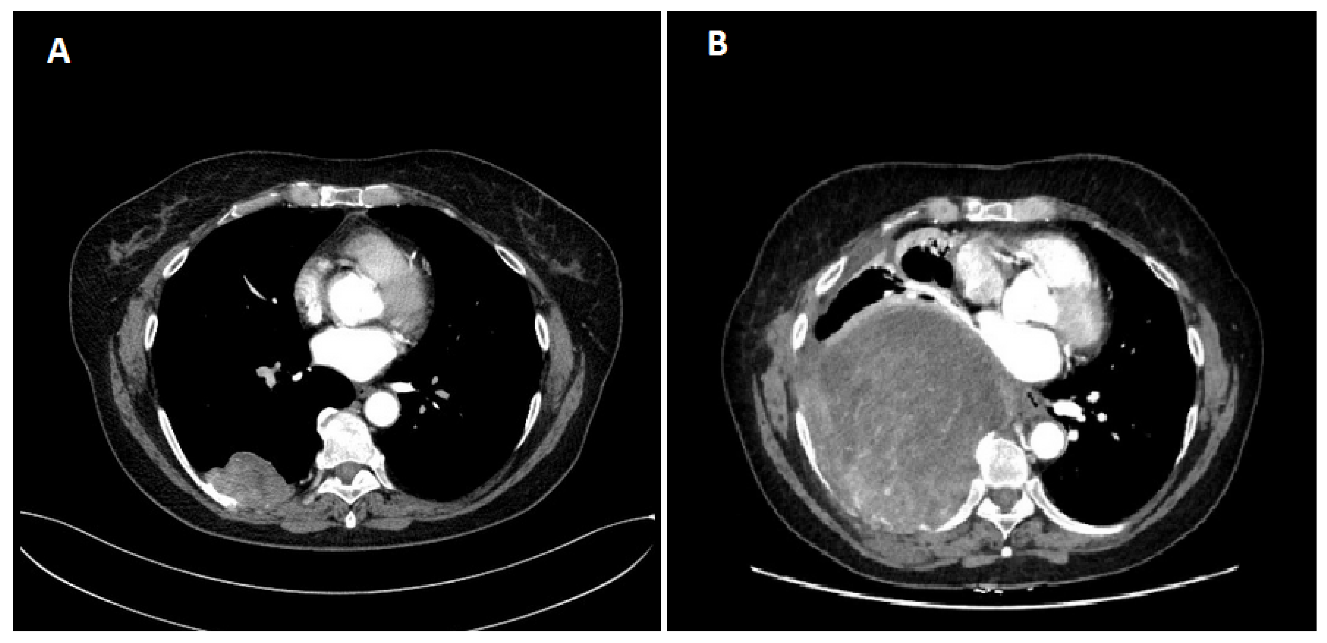 Diseases 12 00181 g001