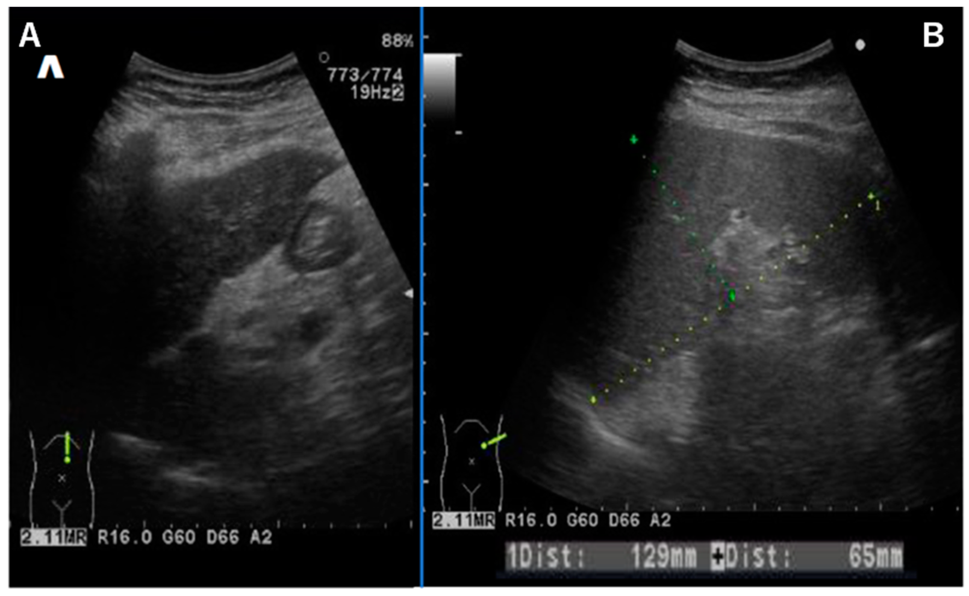 Diseases 12 00251 g002
