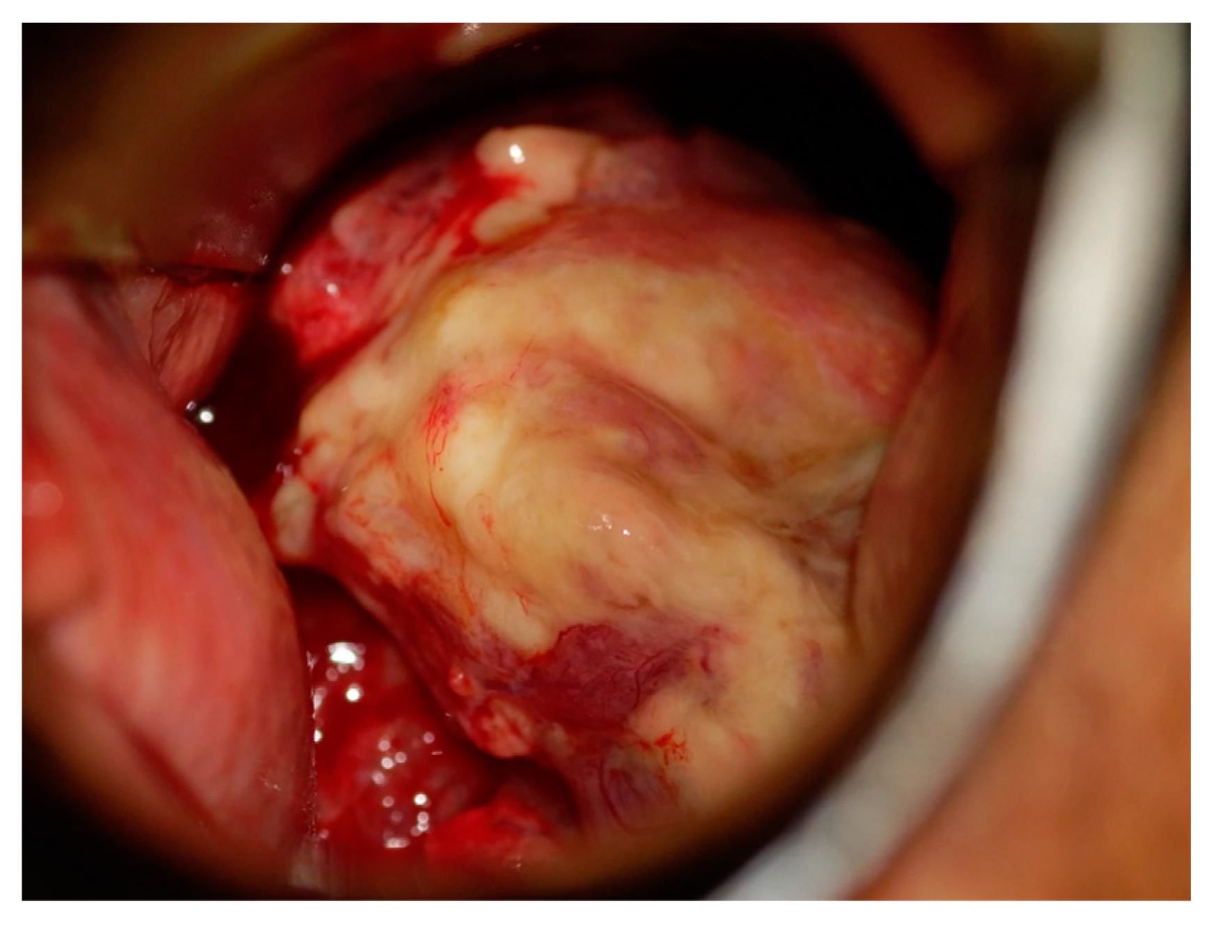 Diseases 12 00282 g001