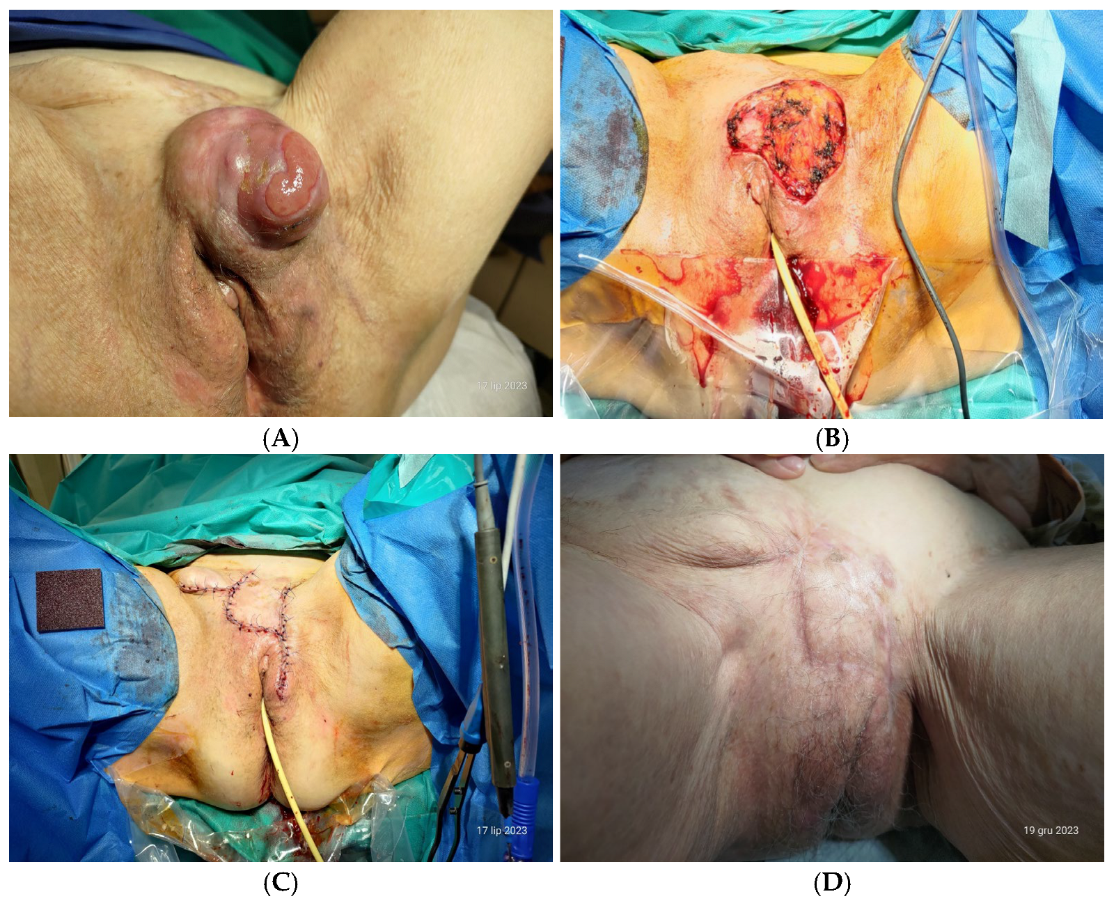 Diseases 12 00299 g001