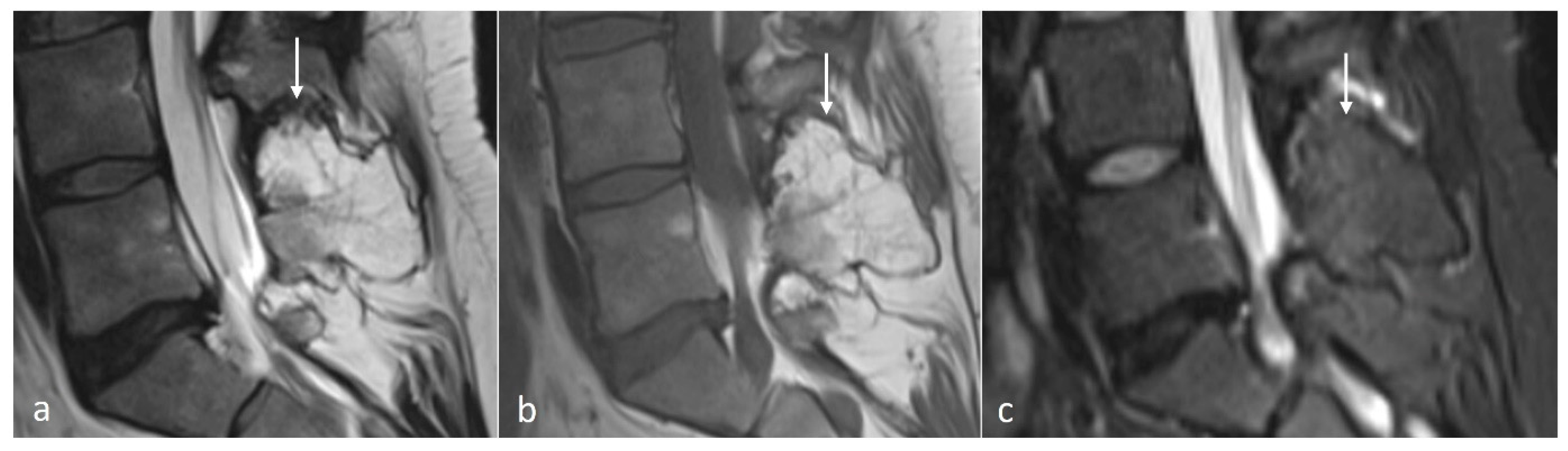 Diseases 12 00302 g003