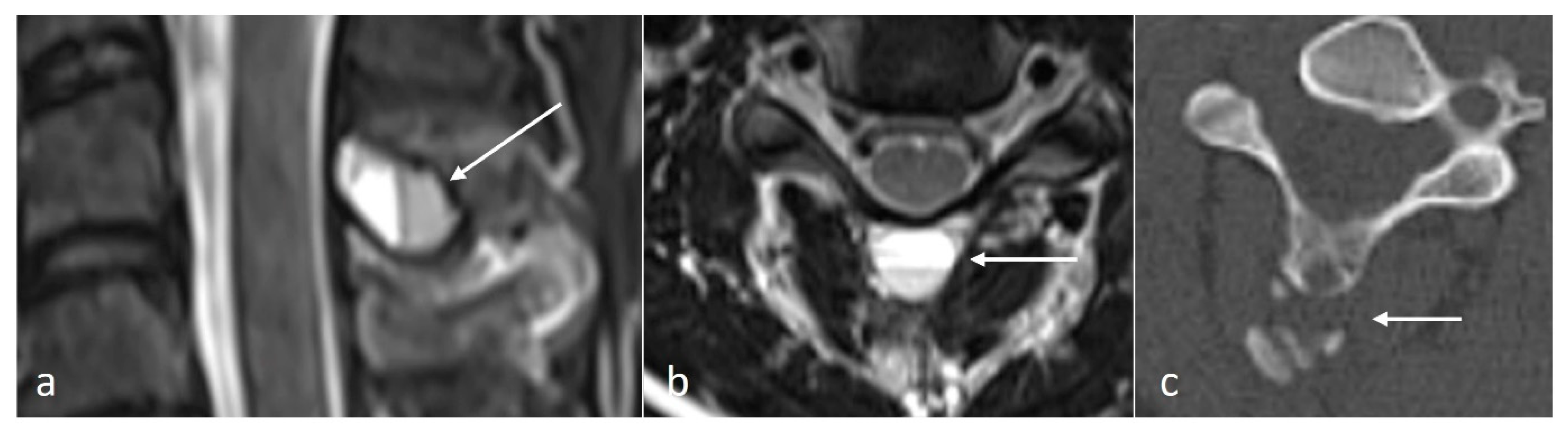 Diseases 12 00302 g004