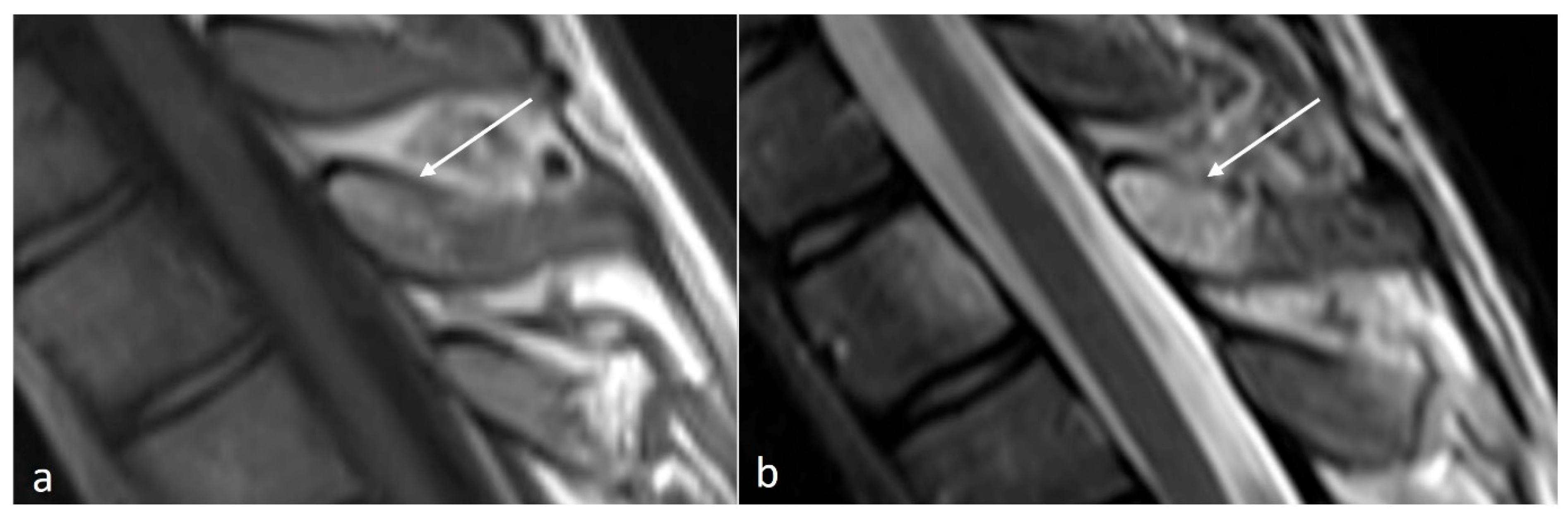 Diseases 12 00302 g005