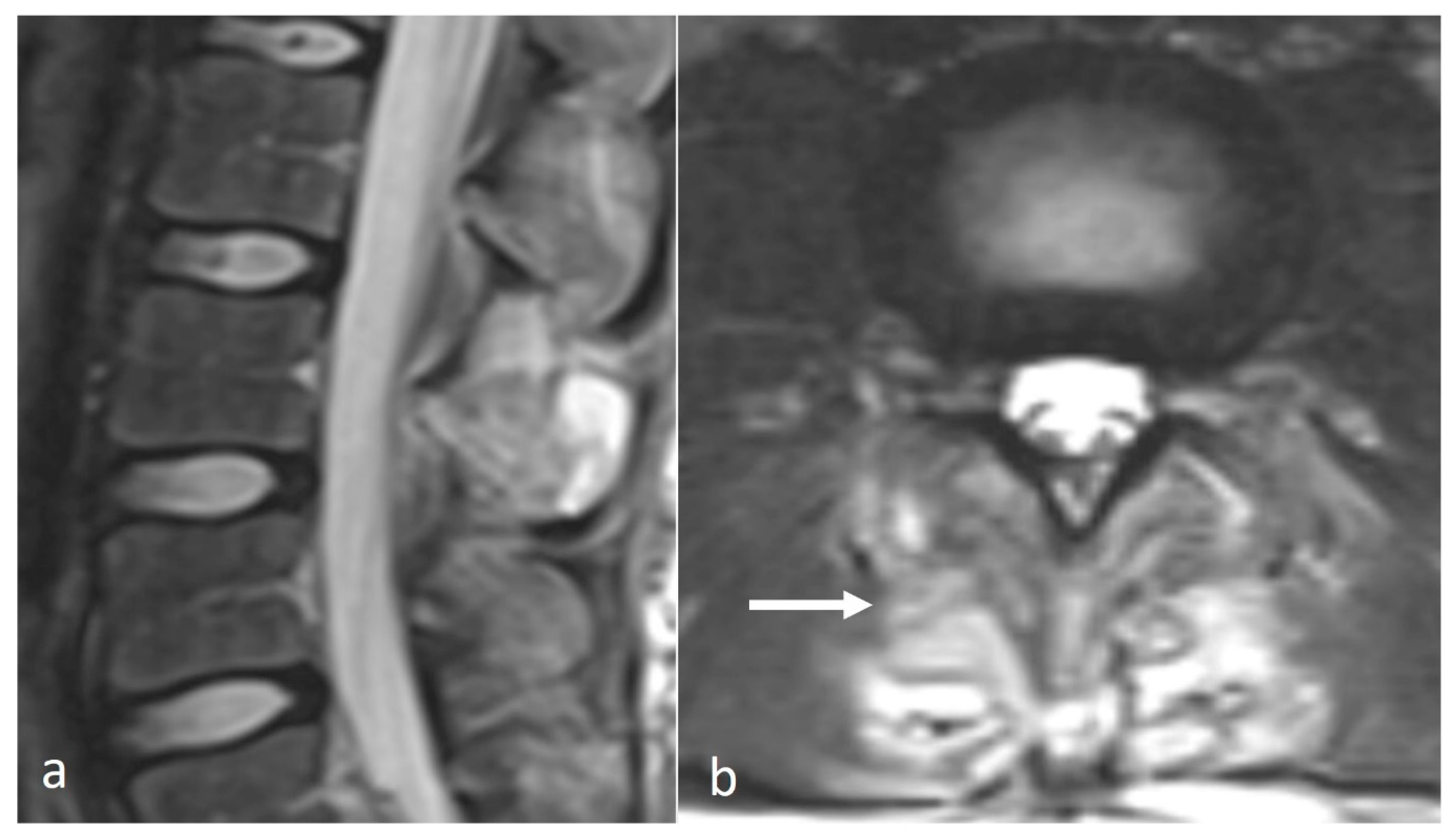 Diseases 12 00302 g009