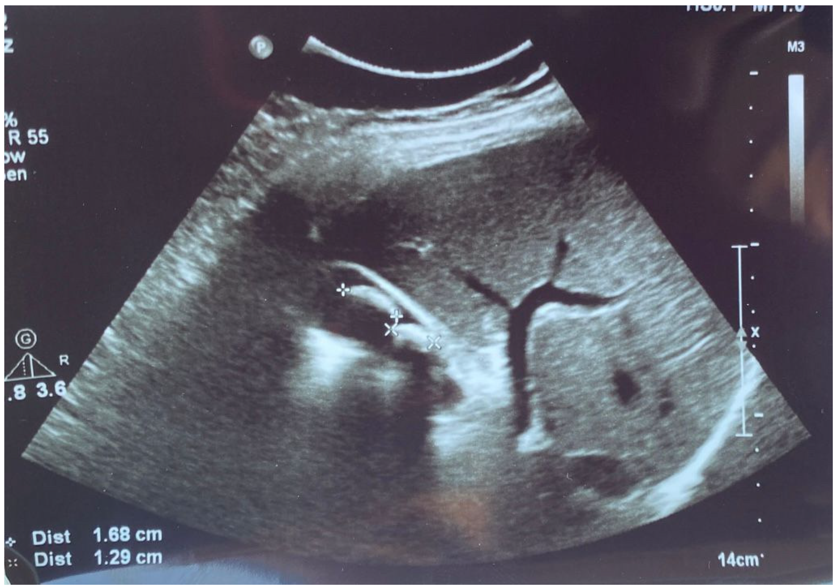 Diseases 12 00326 g001