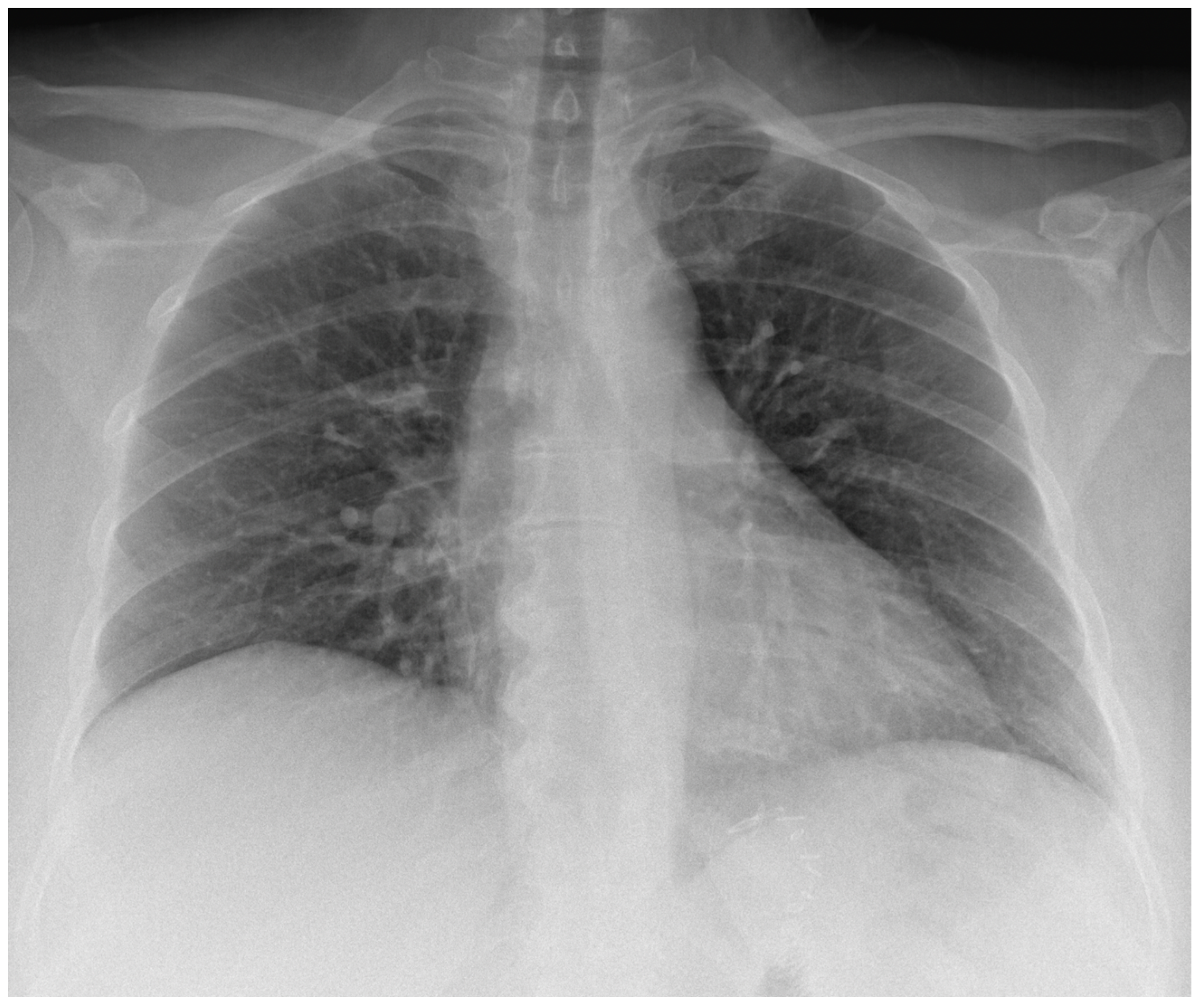 Diseases 12 00326 g004