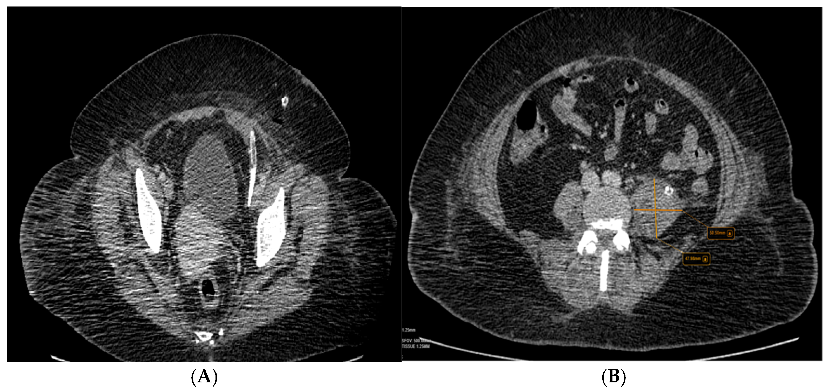 Diseases 12 00326 g005