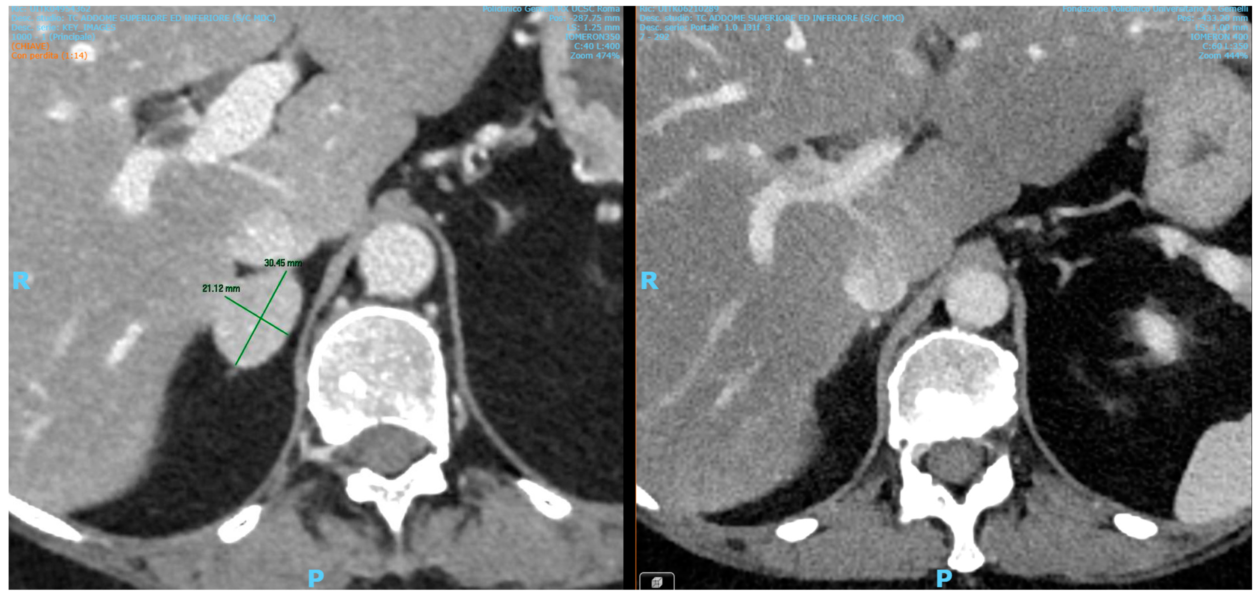 Diseases 13 00020 g001