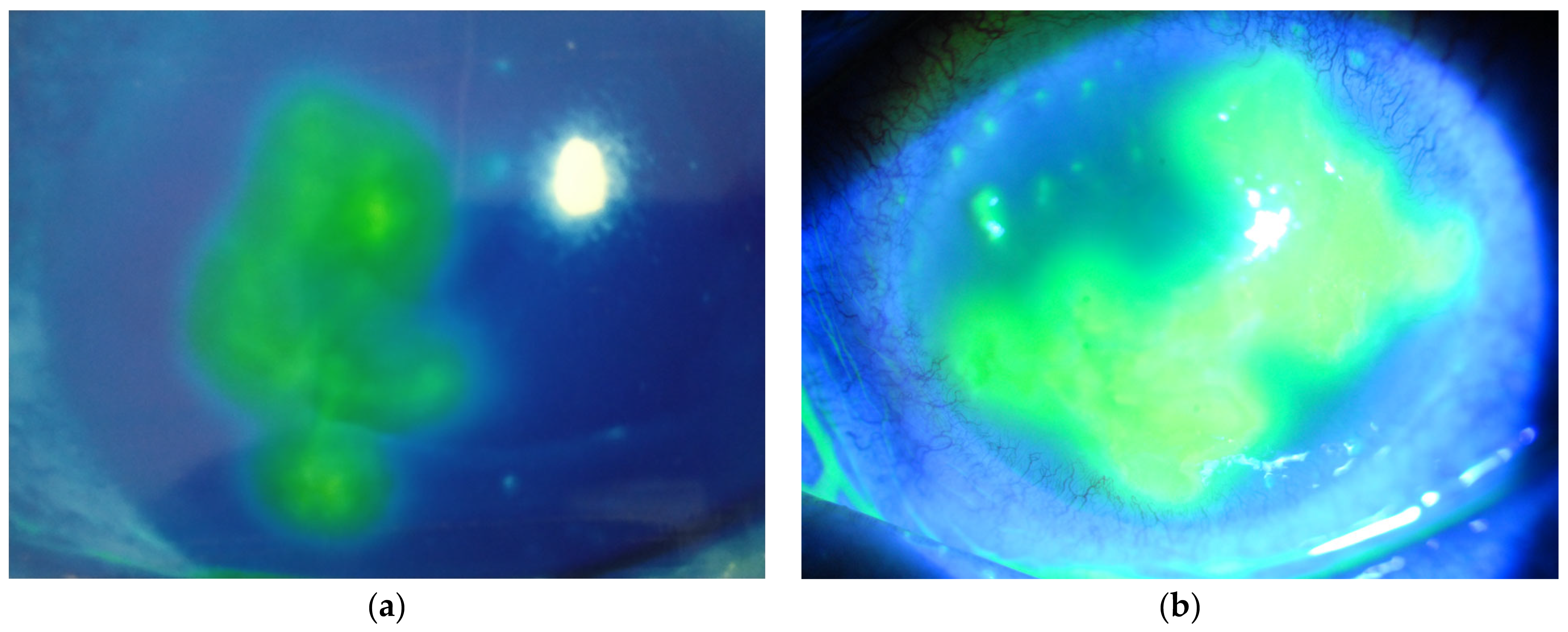 Diseases 13 00038 g001