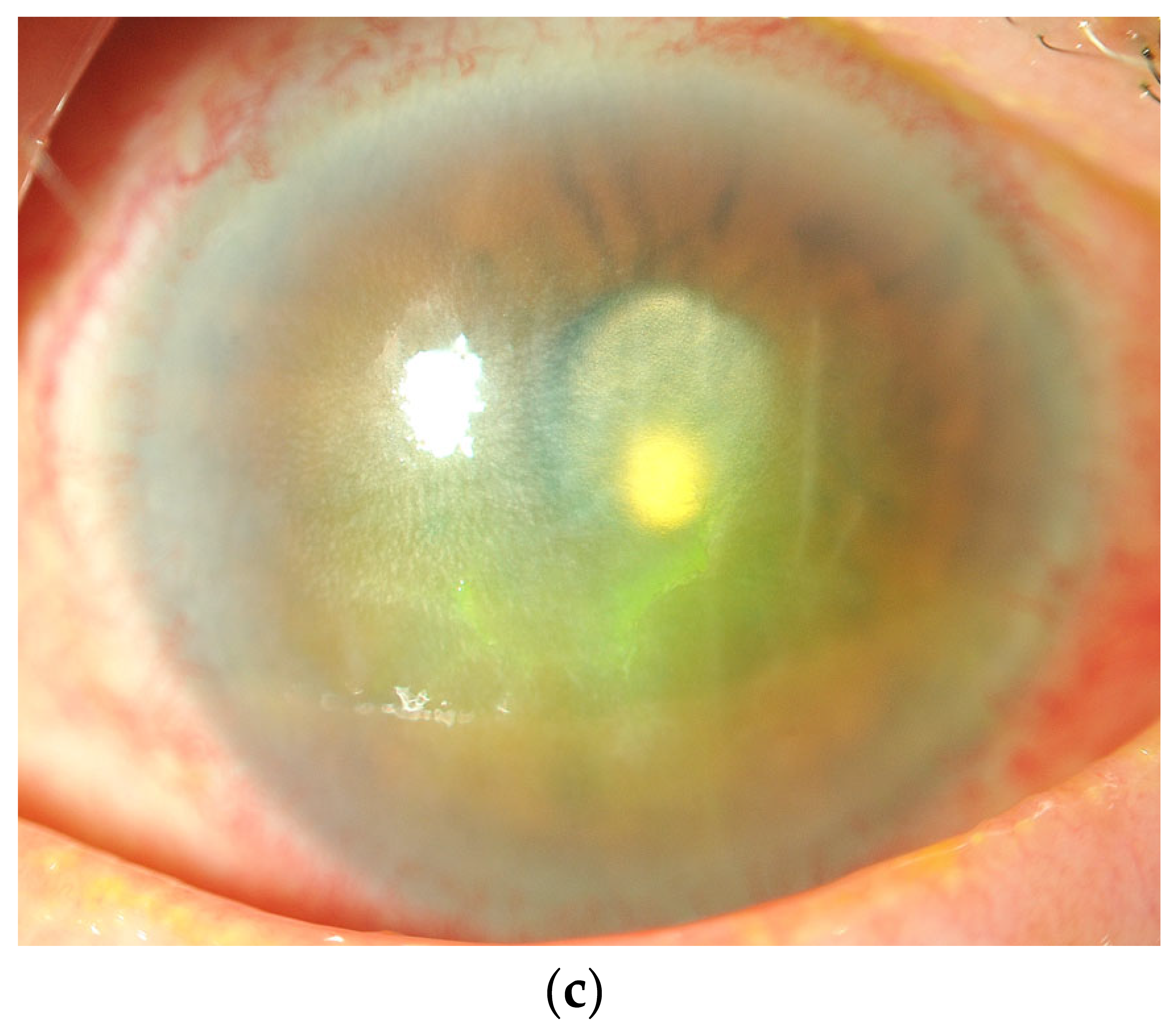 Diseases 13 00038 g002b