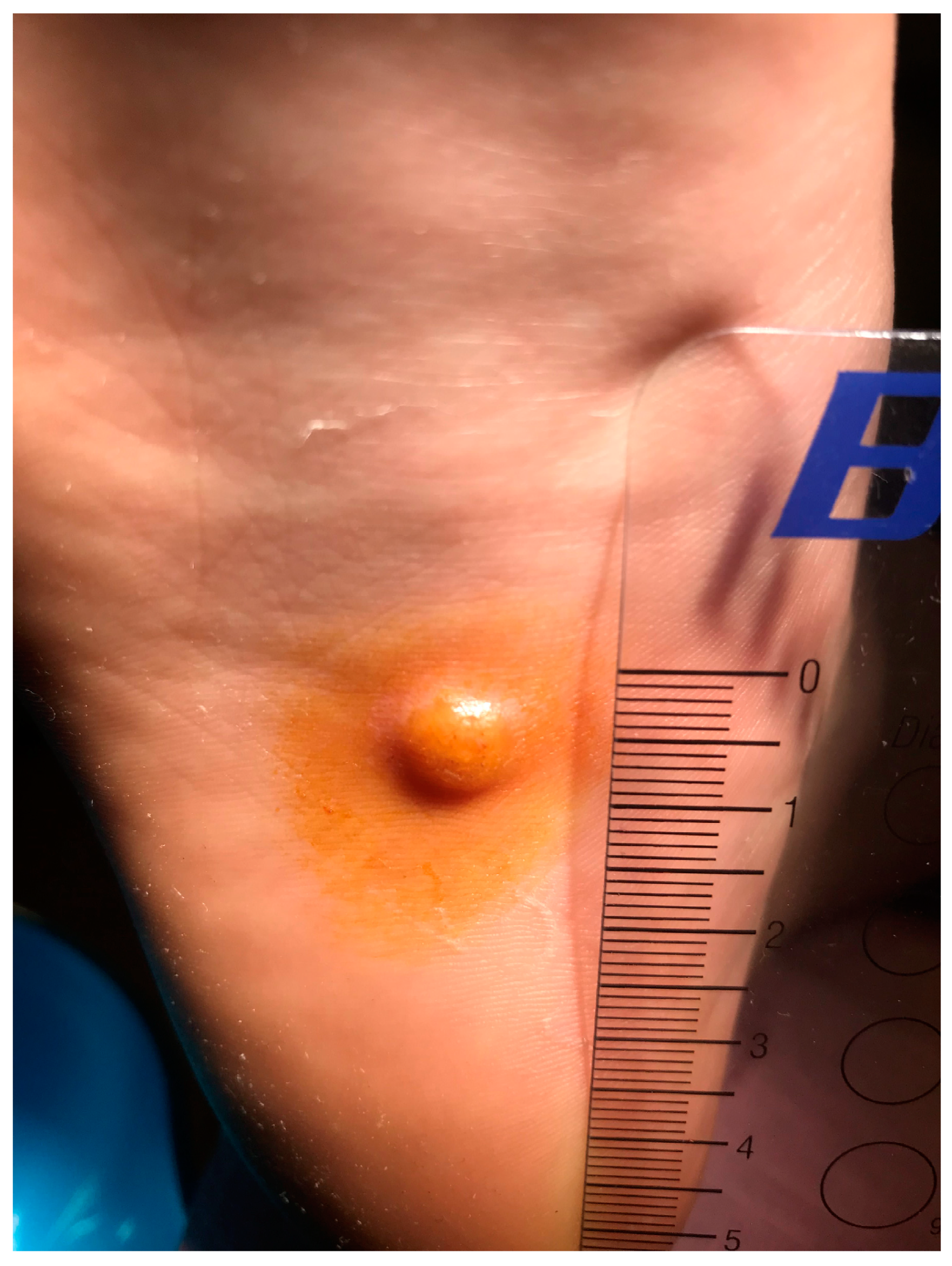 Diseases 13 00050 g001